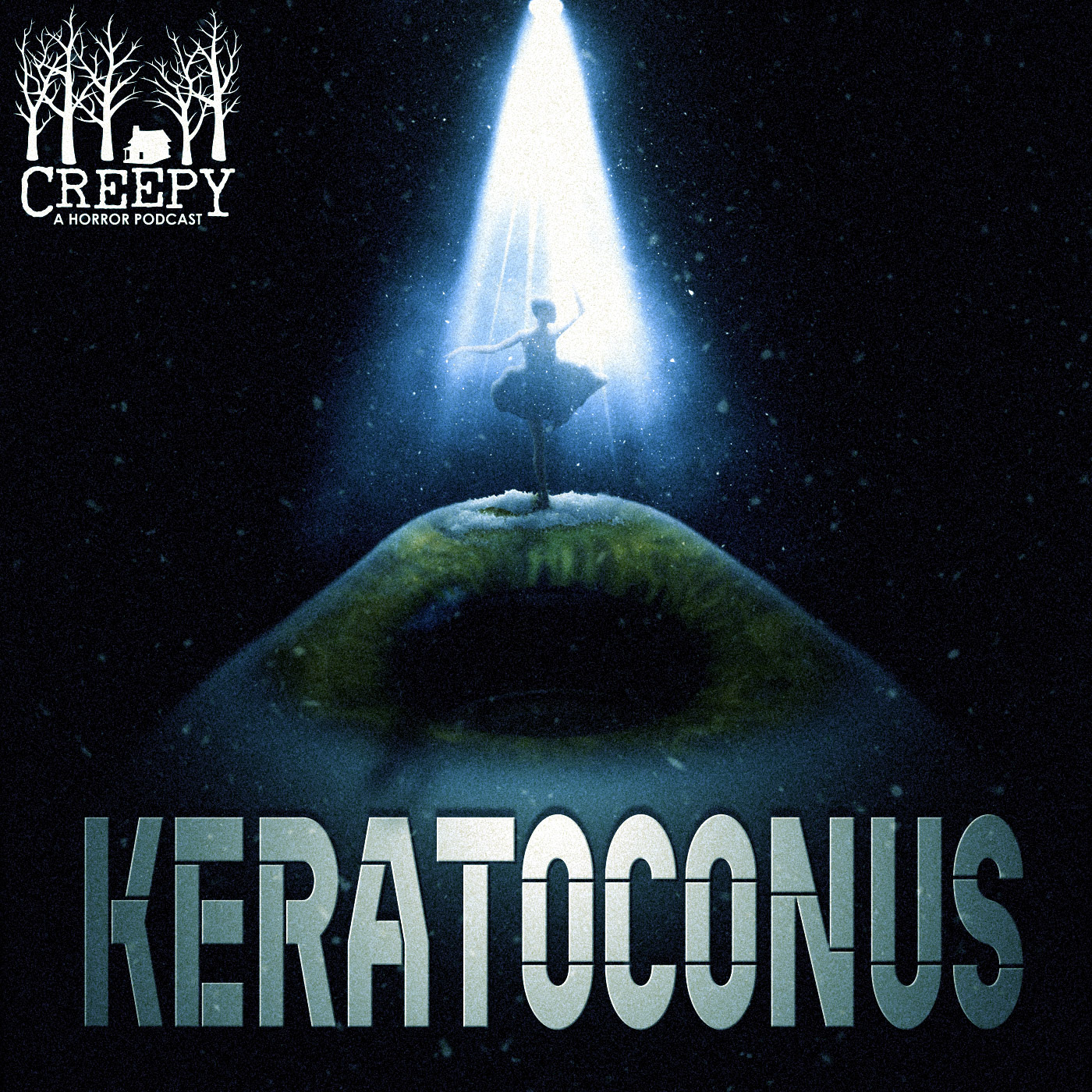 Keratoconus