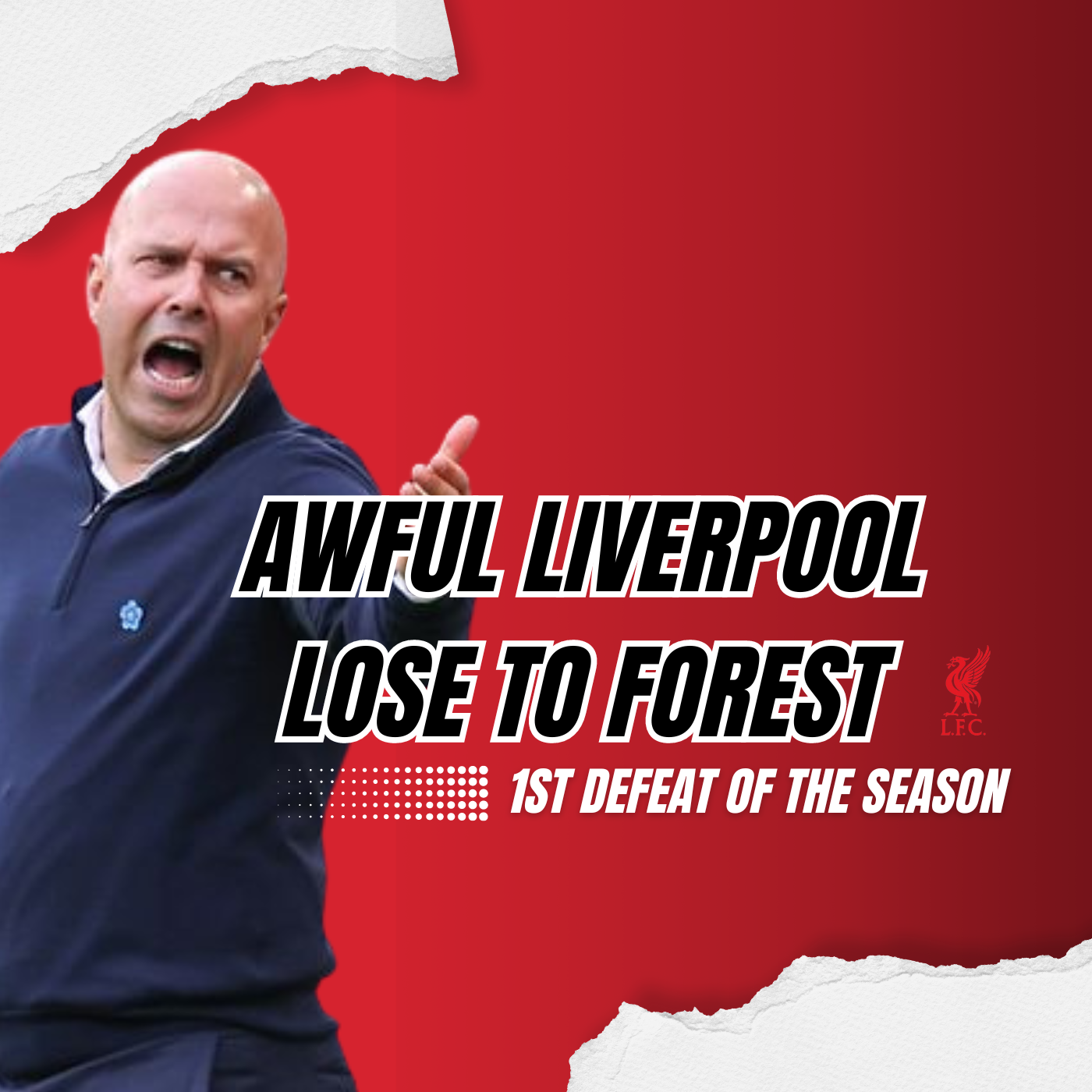 Awful Liverpool Lose To Forest | Sunday Night Kop episode artwork
