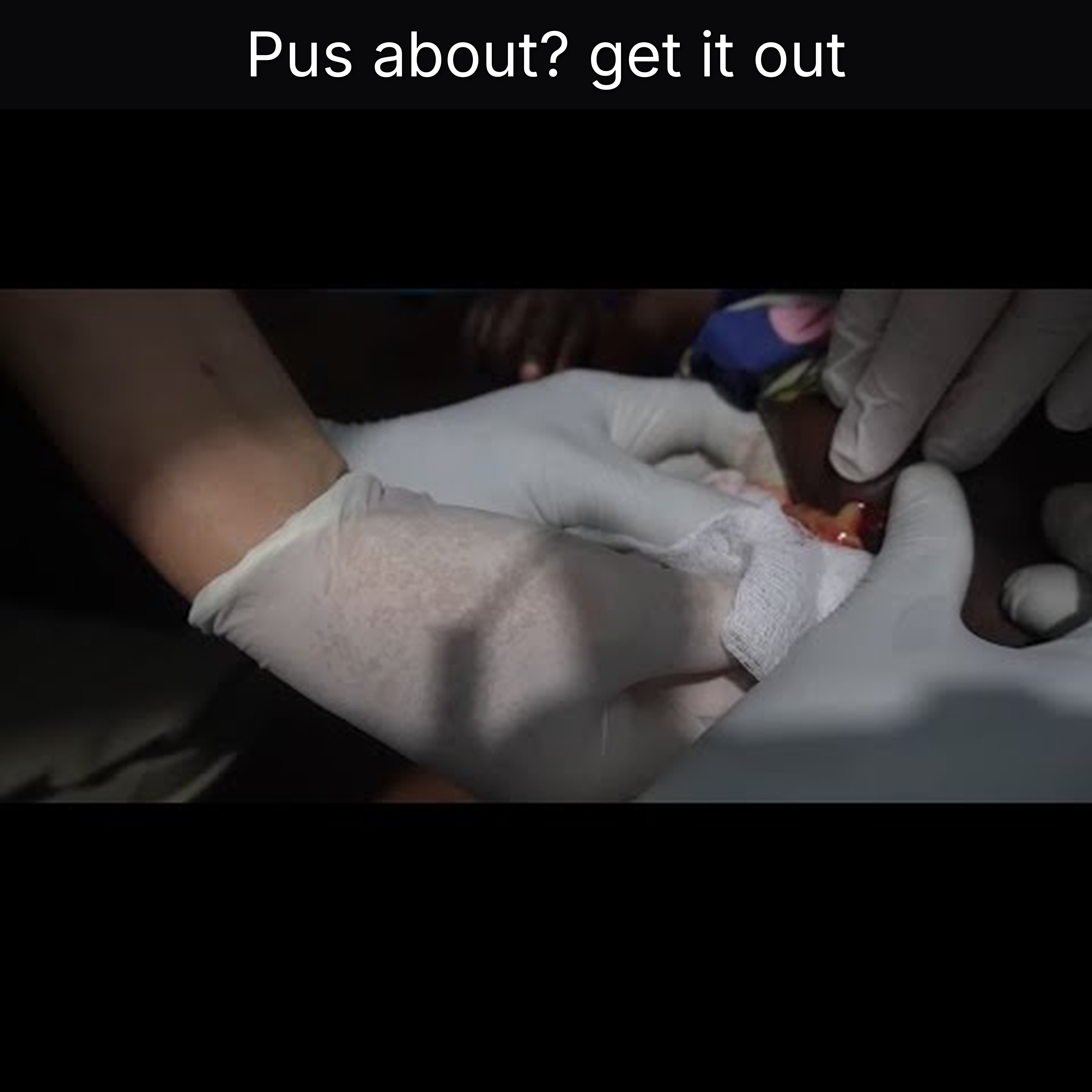 Pus about? get it out episode artwork