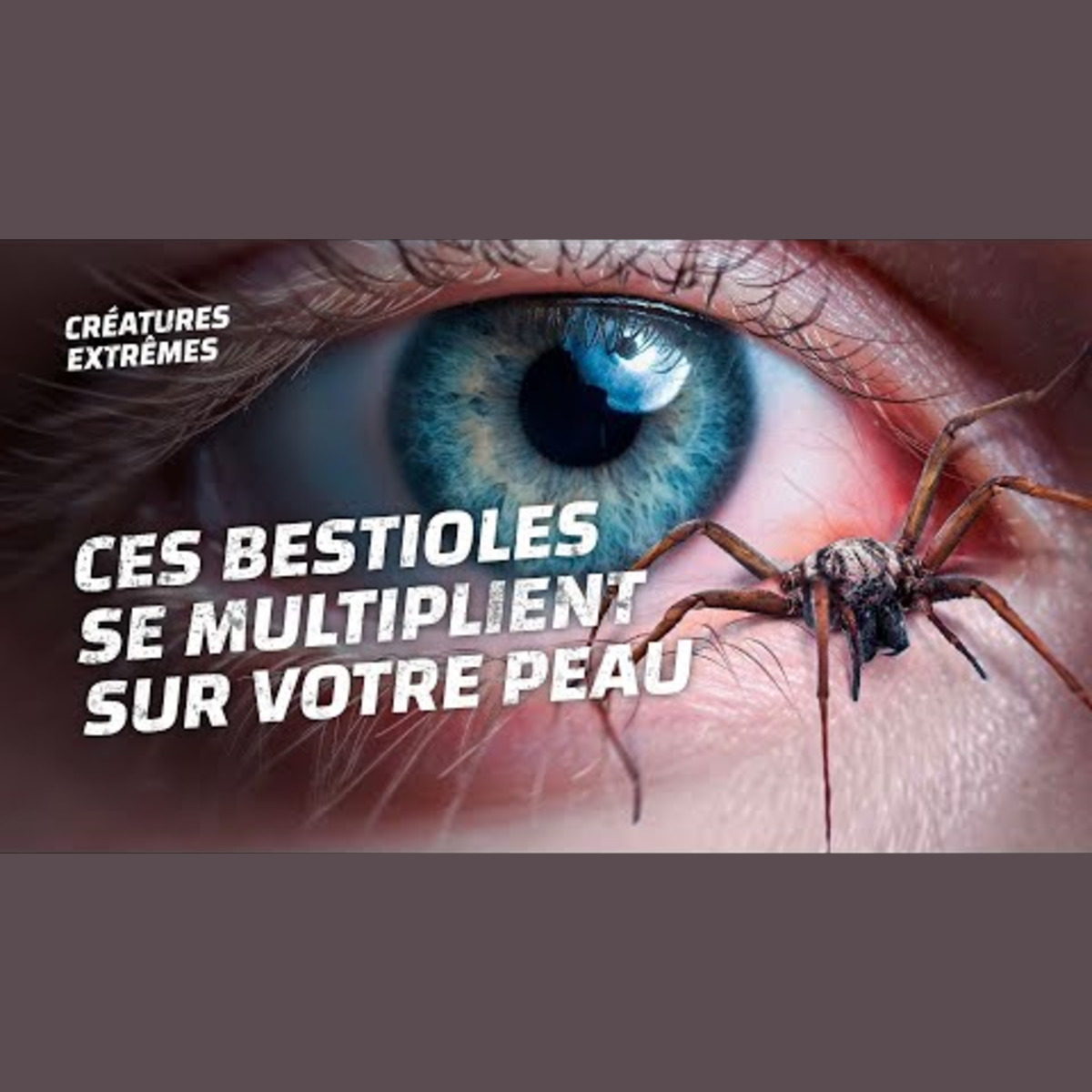 Ces bestioles vivent sur votre visage