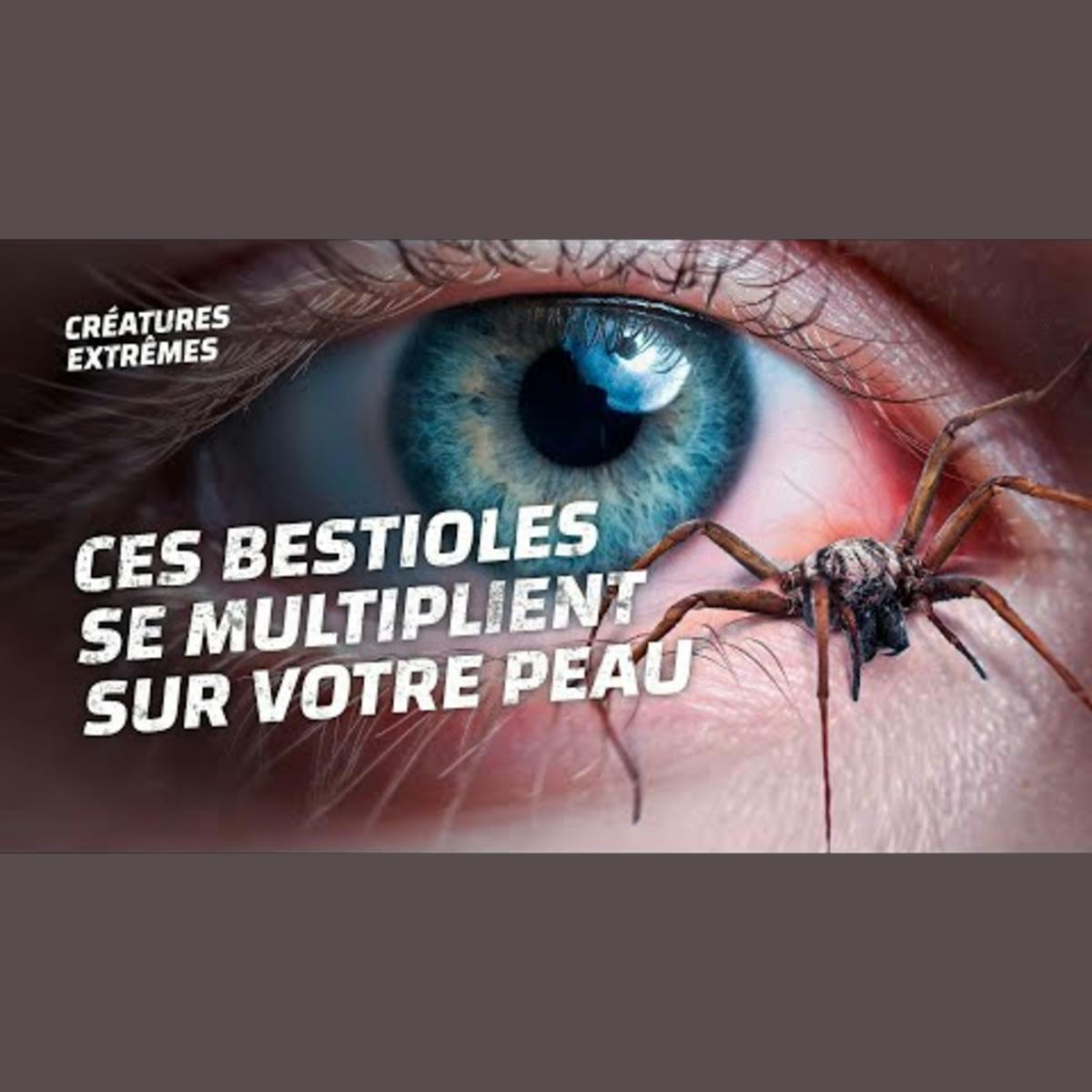Ces bestioles vivent sur votre visage Ces bestioles vivent sur votre visage