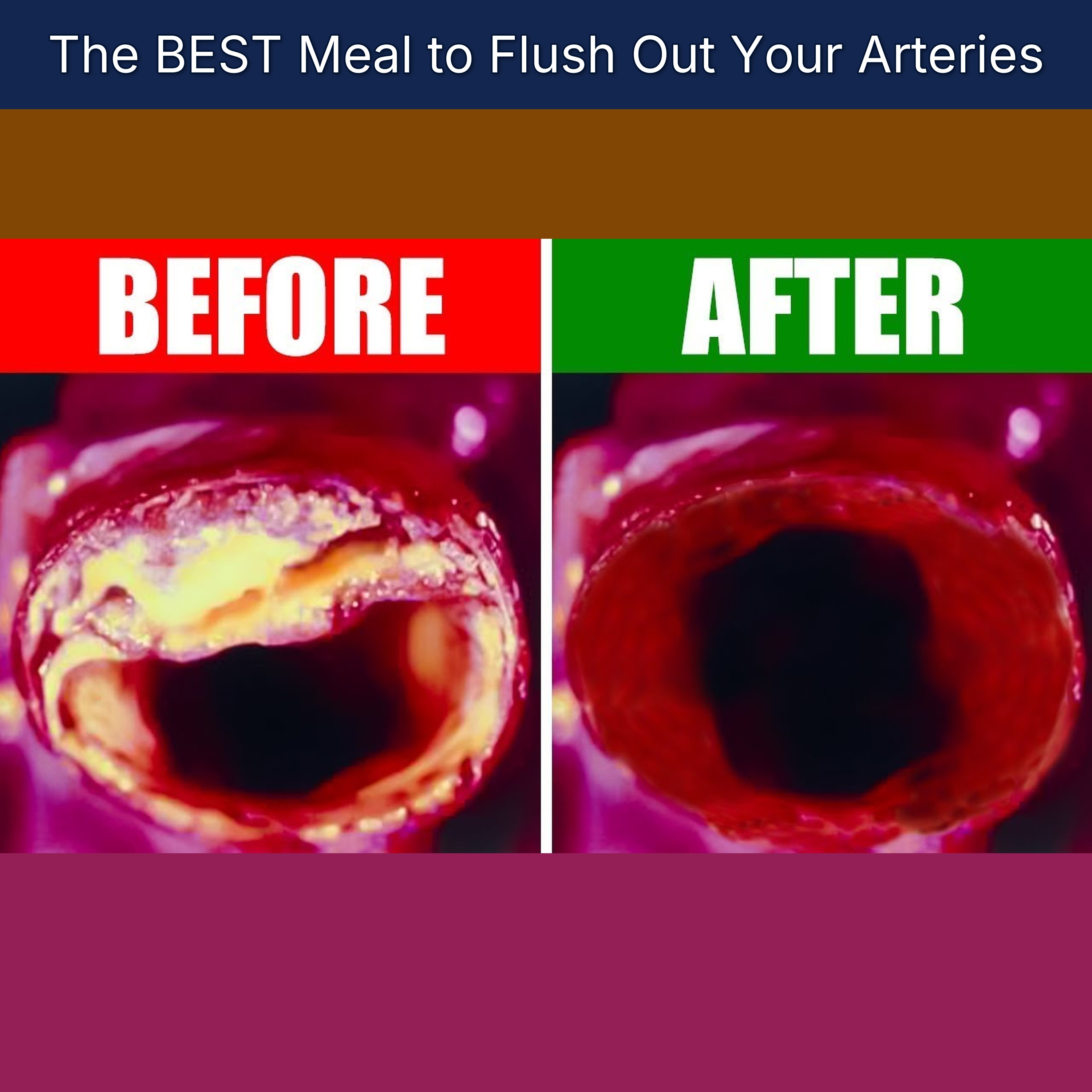 The BEST Meal to Flush Out Your Arteries