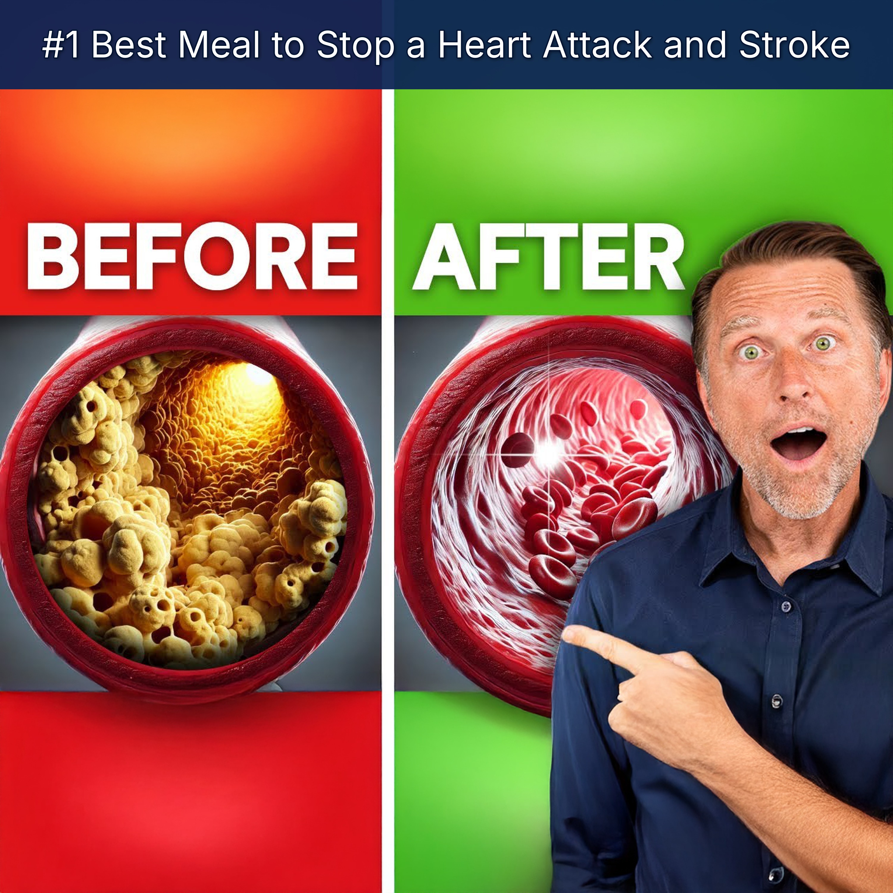 #1 Best Meal to Stop a Heart Attack and Stroke