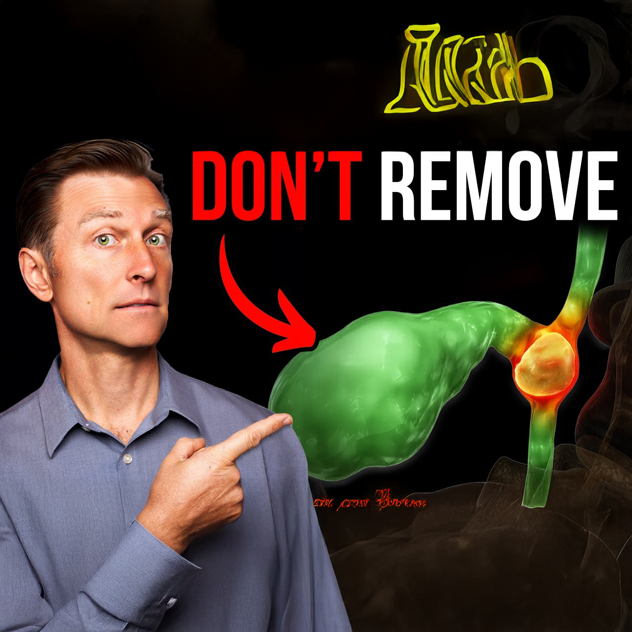 Never Get Your Gallbladder Removed