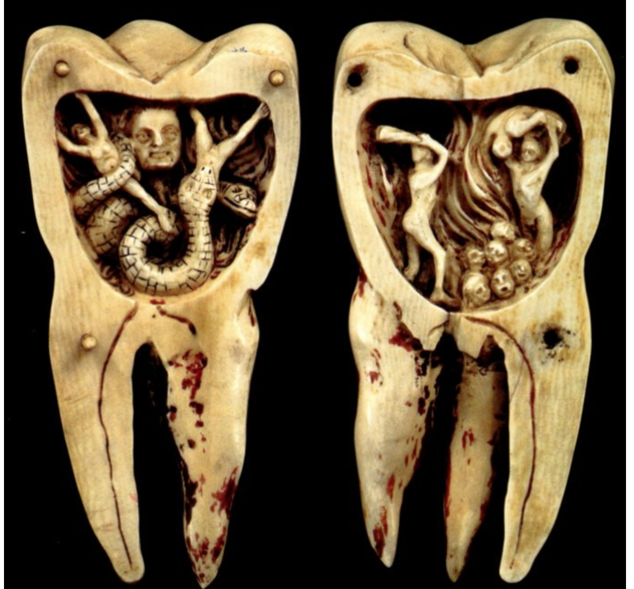 Tooth Worms and Tooth Pullers: Dentistry’s Rotten History