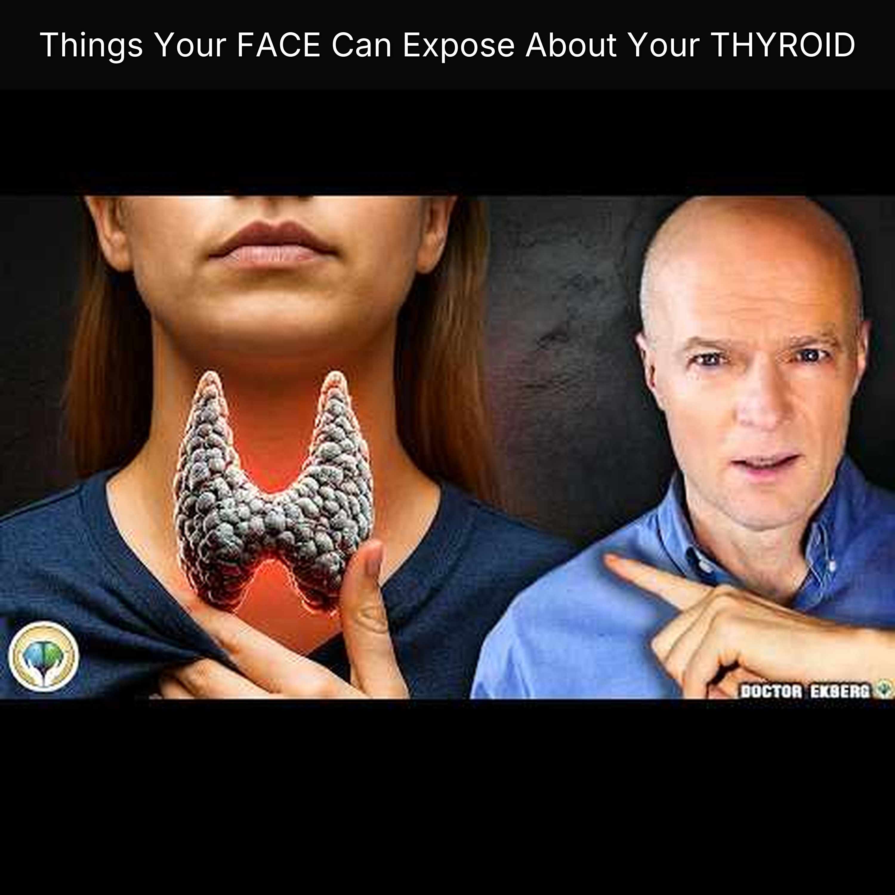 Things Your FACE Can Expose About Your THYROID episode artwork