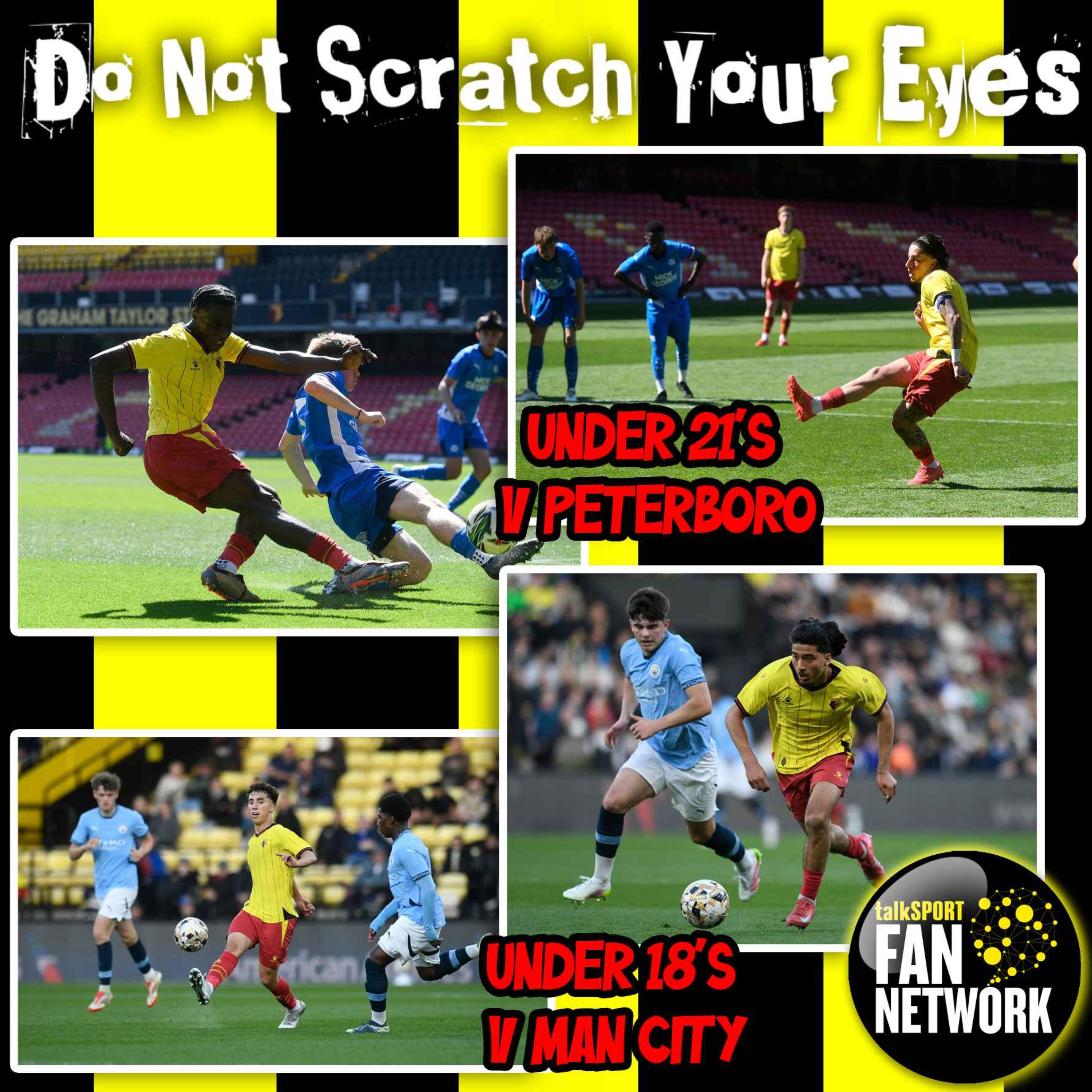 Do Not Scratch Your Eyes