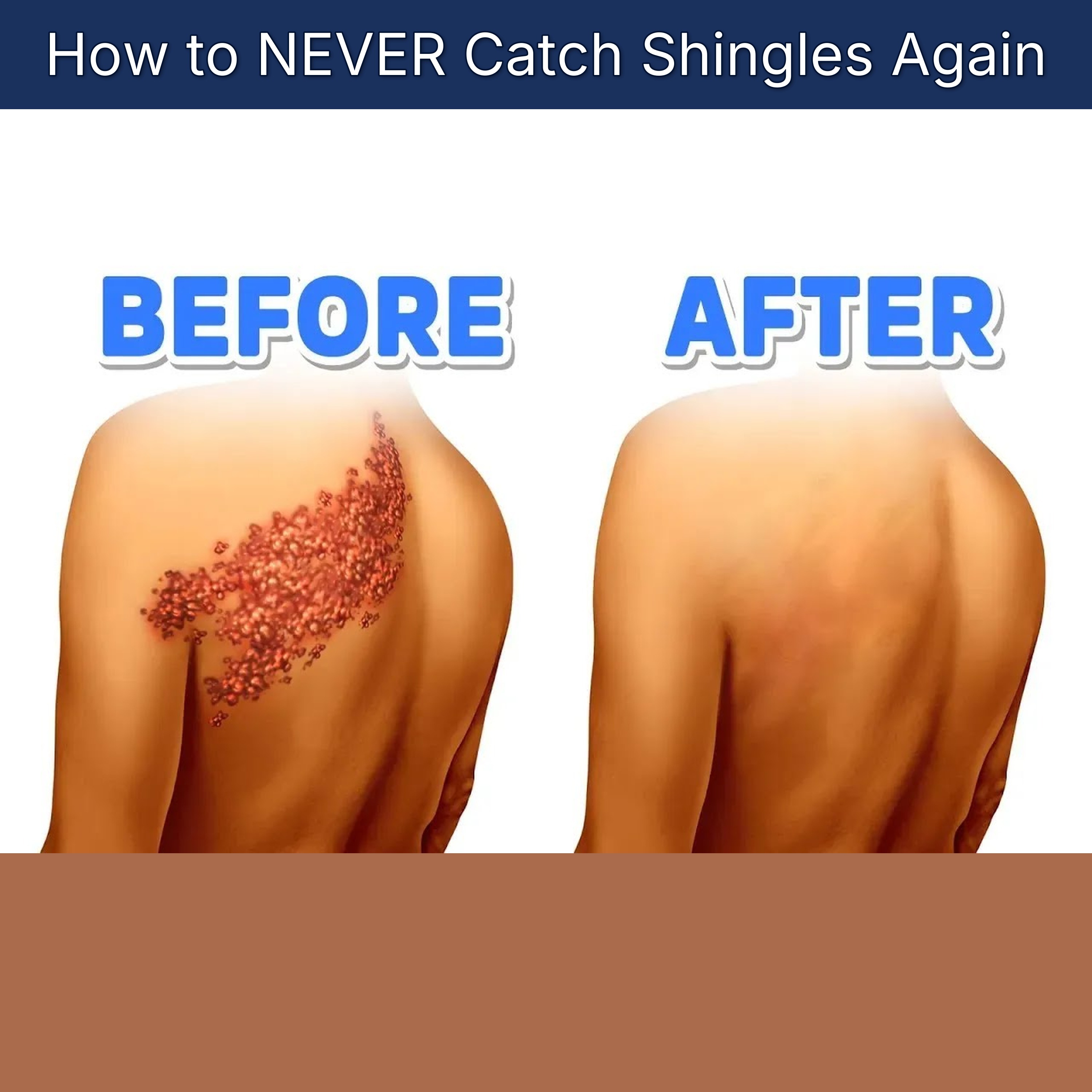 How to NEVER Catch Shingles Again