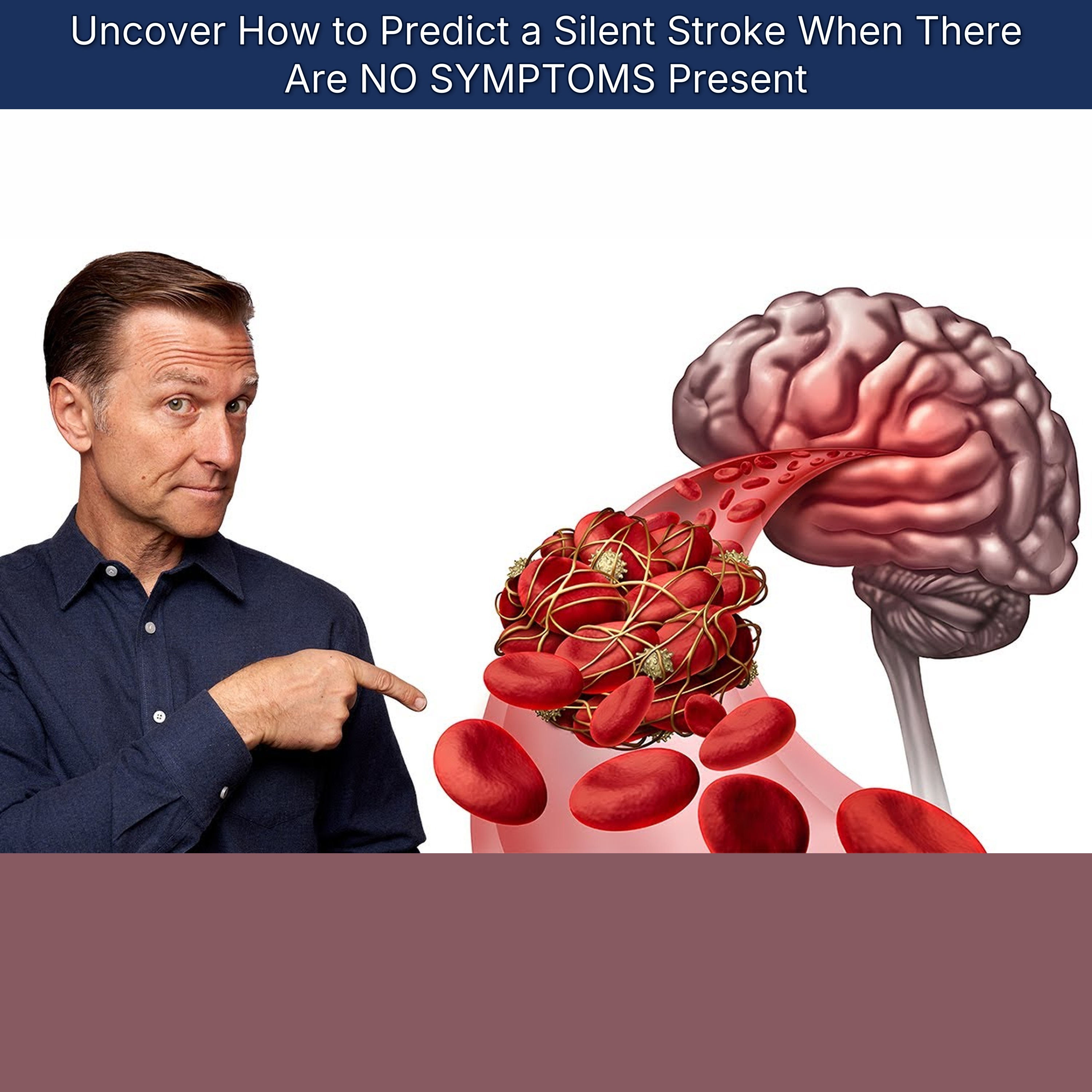 Uncover How to Predict a Silent Stroke When There Are NO SYMPTOMS Present