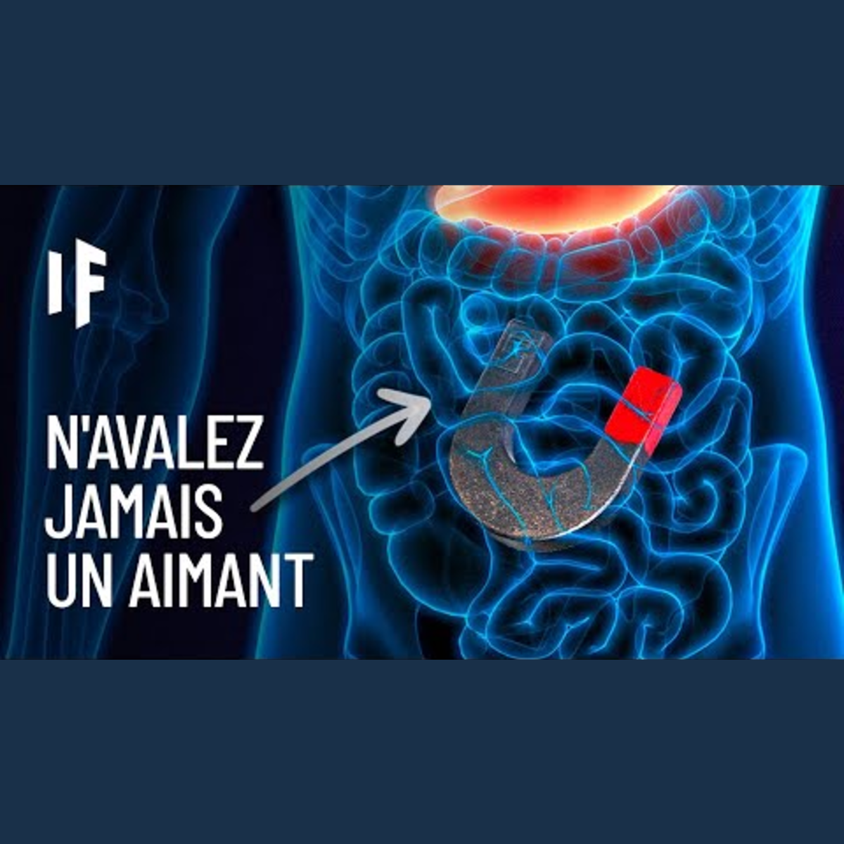 What If Français - Et Si