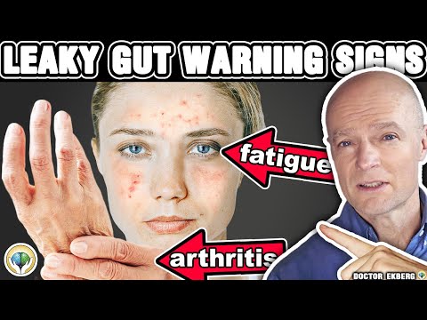 10 Signs That You Have A Leaky Gut episode artwork