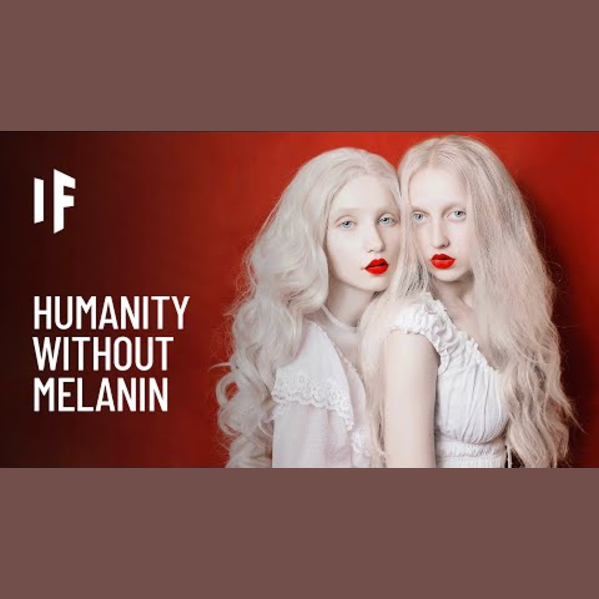 What If Everyone Was Albino? episode artwork