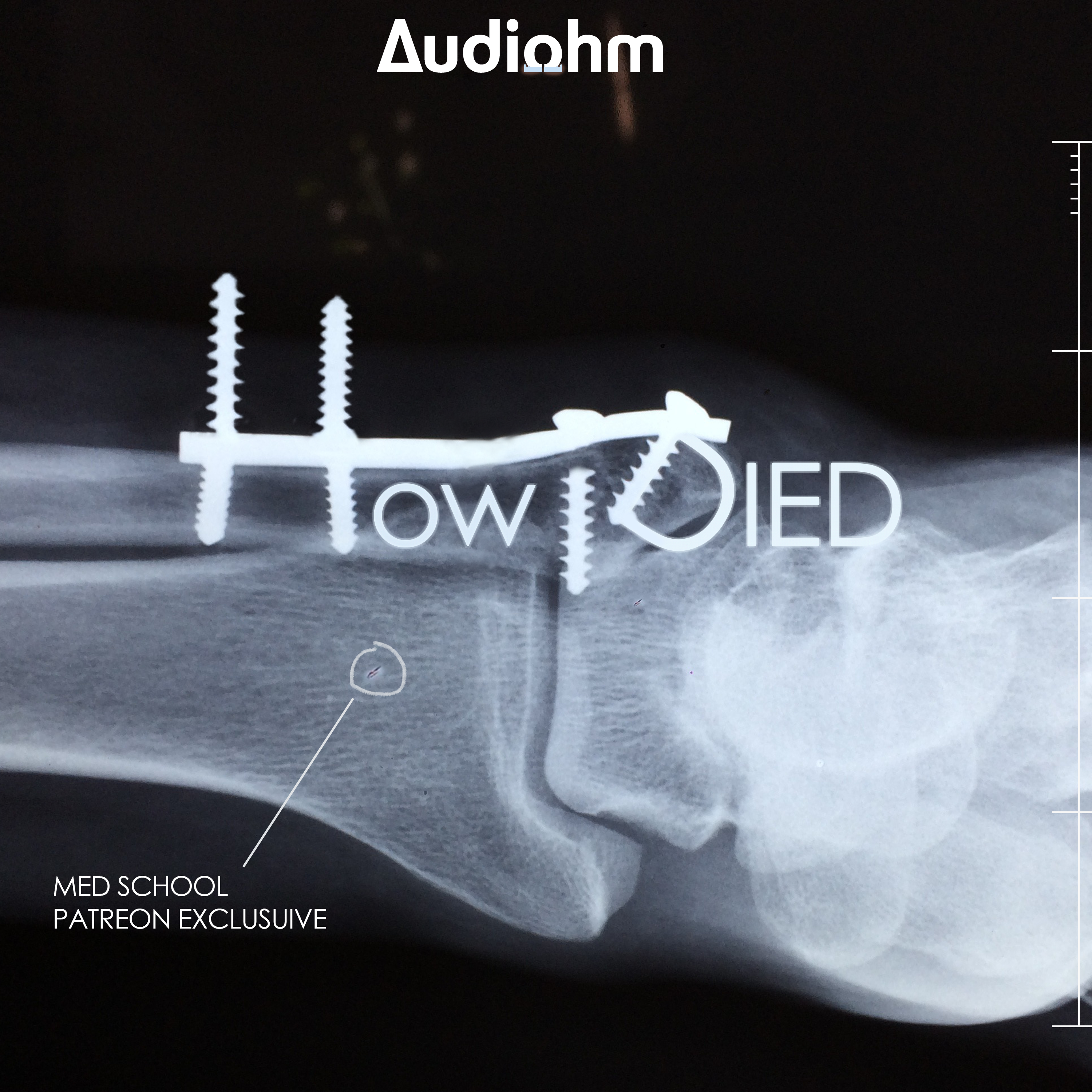 How i Died: Med School Prequel Series -- OUT NOW!