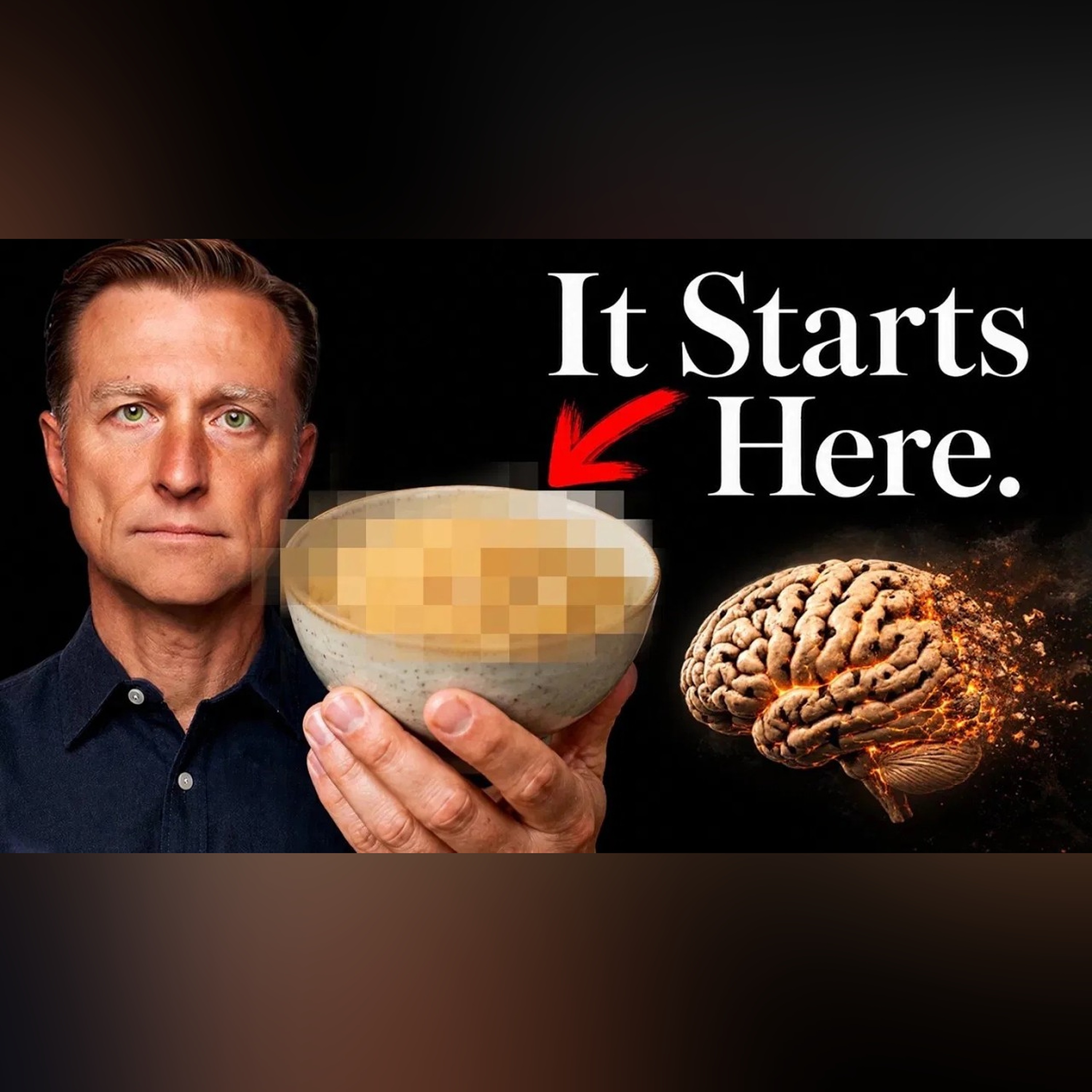 Memory Loss Has Nothing to Do with Your Age (Watch Out for This Instead) episode artwork
