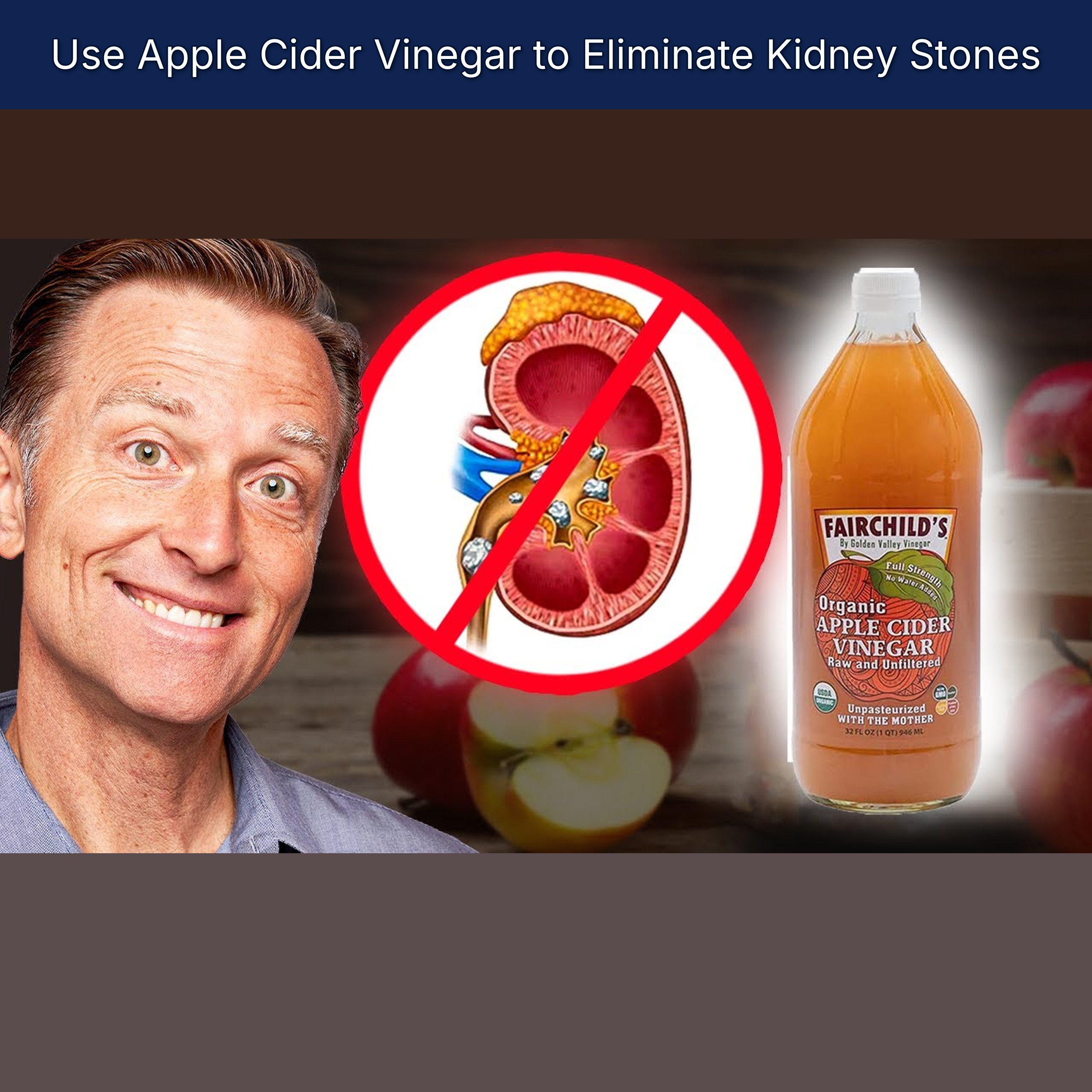 Use Apple Cider Vinegar to Eliminate Kidney Stones