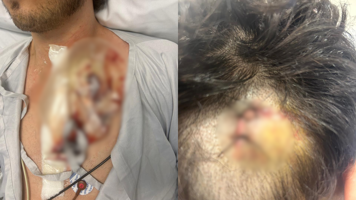 Justiça determina que investigação de ataque na Rua da Consolação seja feita pelo DHPP