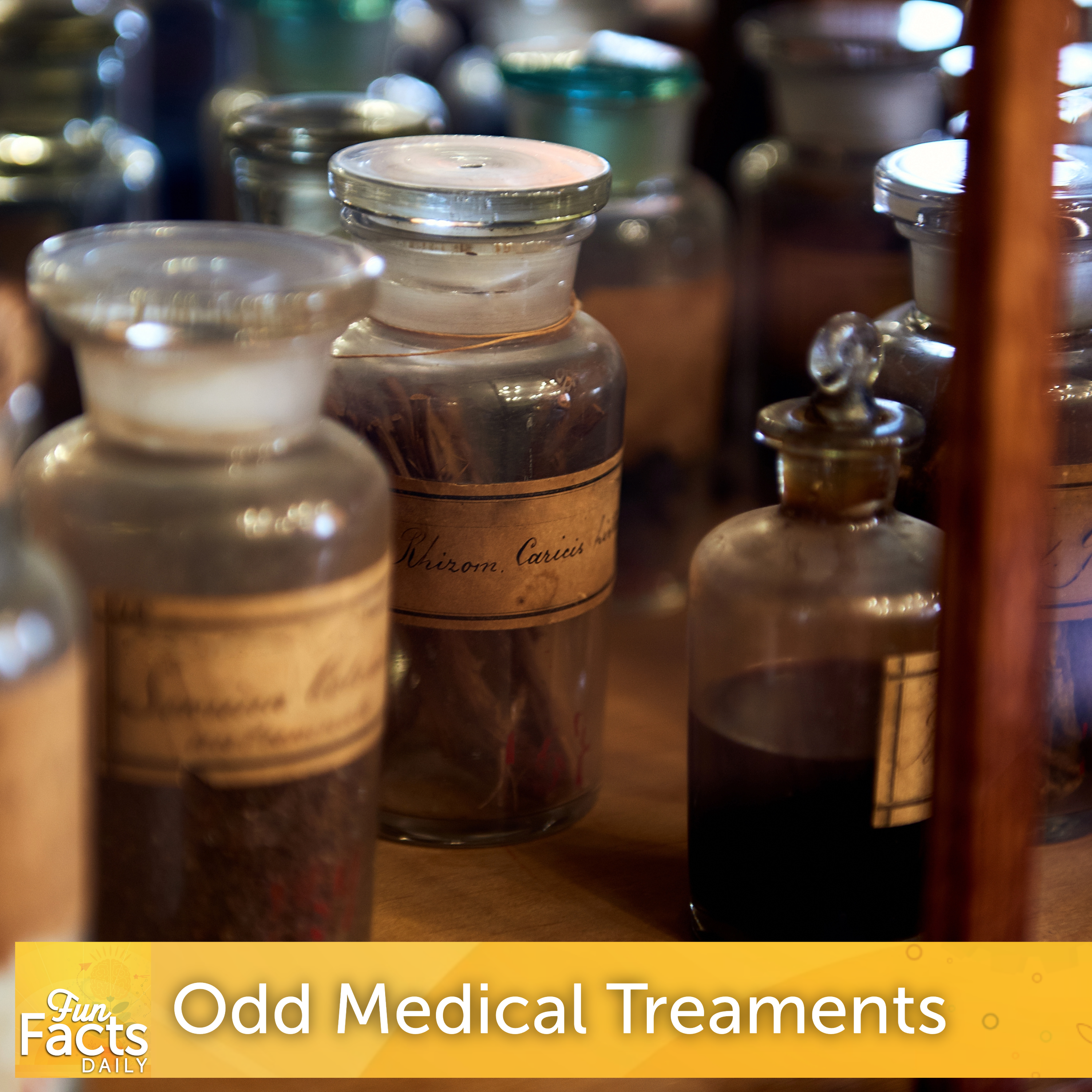 Fun Facts About History's Oddest Medical Treatments