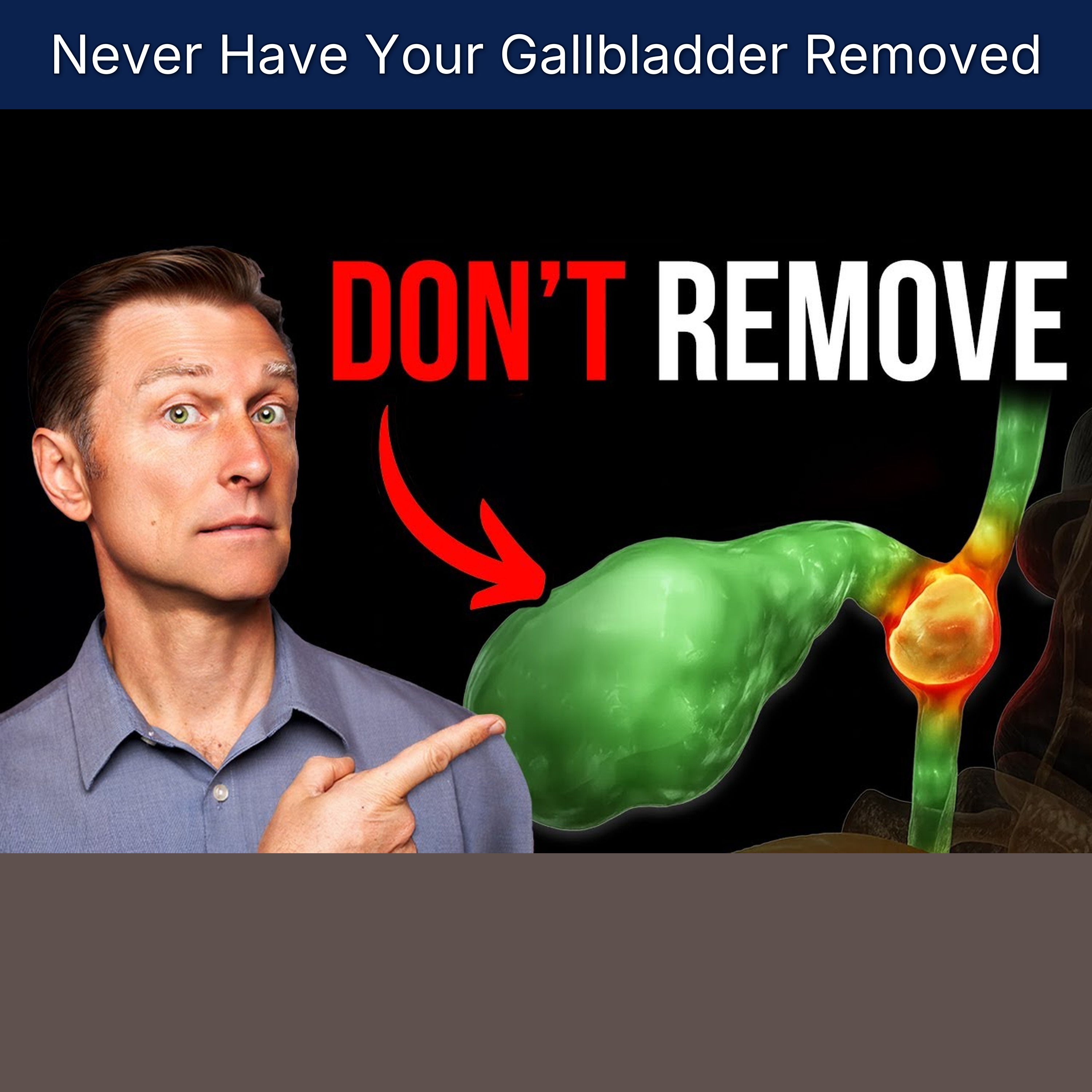 Never Have Your Gallbladder Removed