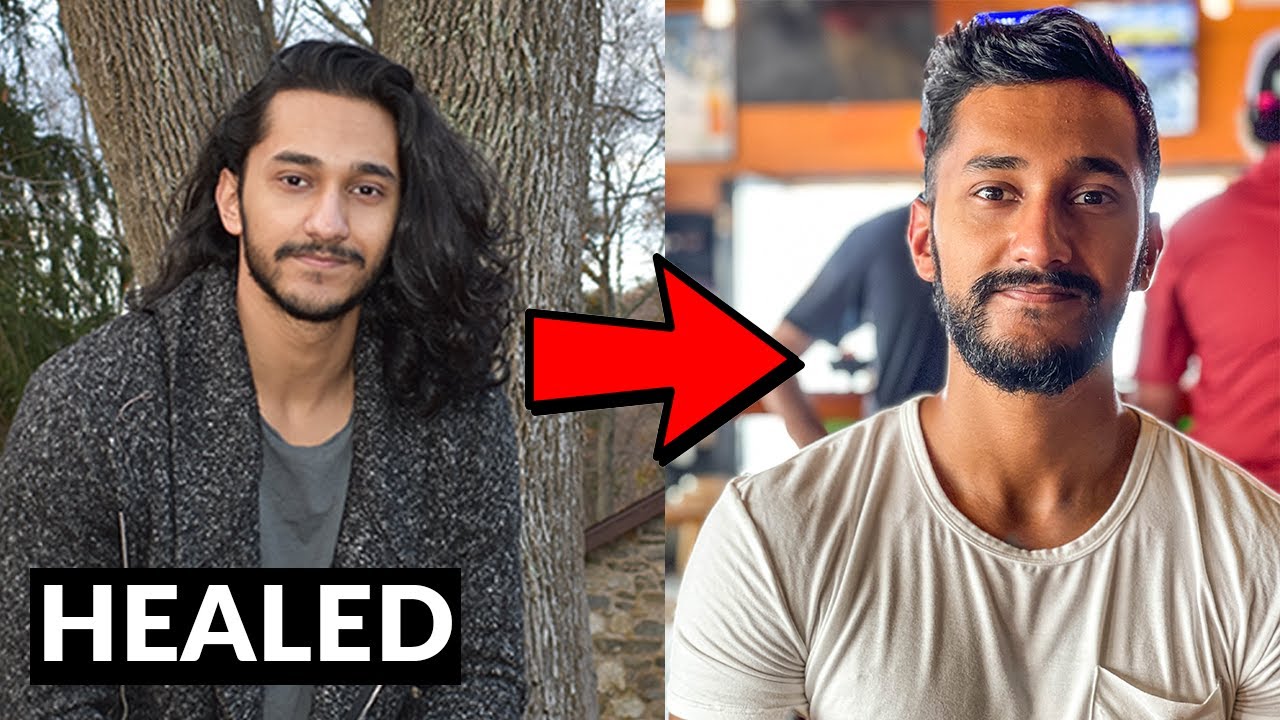 How I Healed Myself By Introducing These 4 Lifestyle Hacks | Quazi Johir