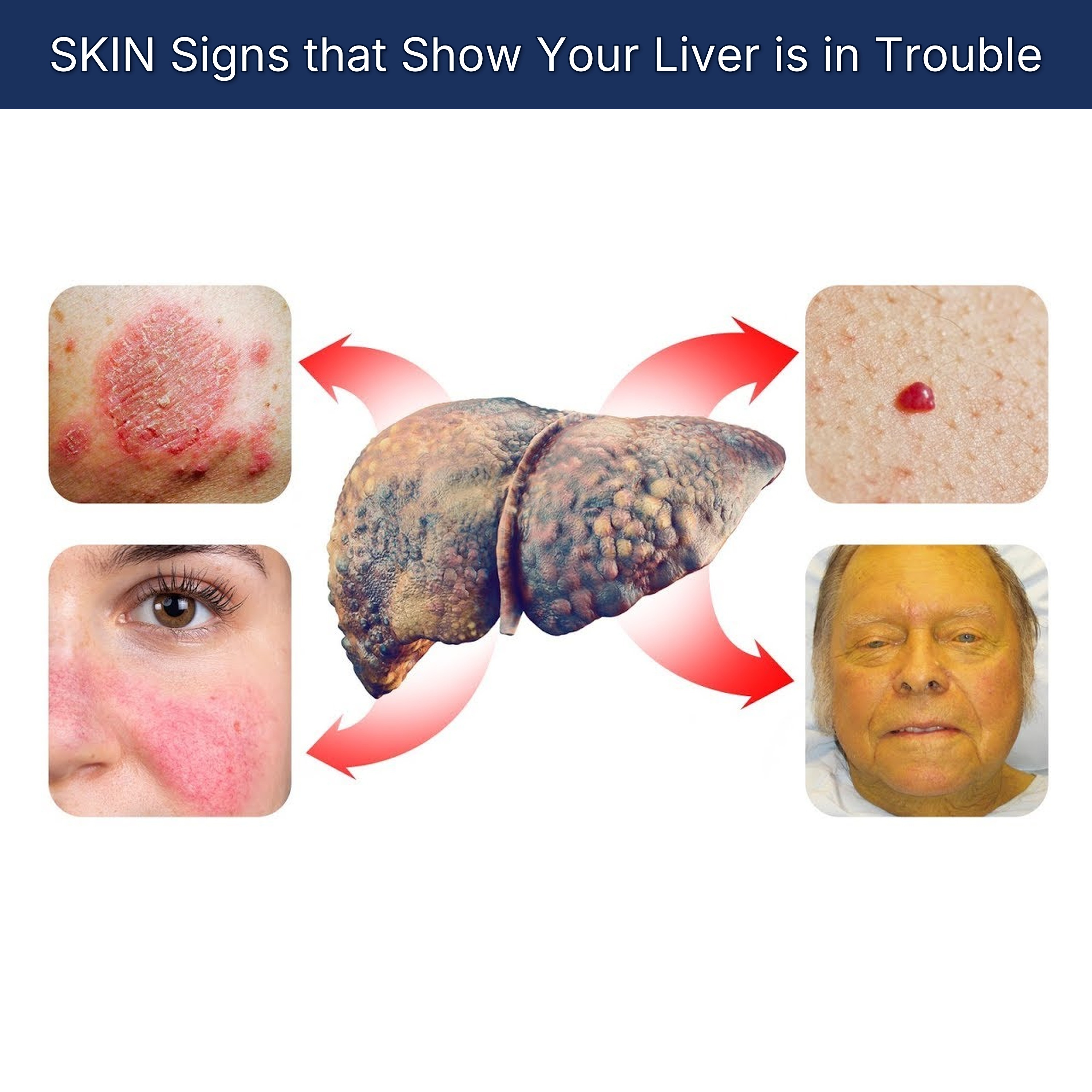 SKIN Signs that Show Your Liver is in Trouble