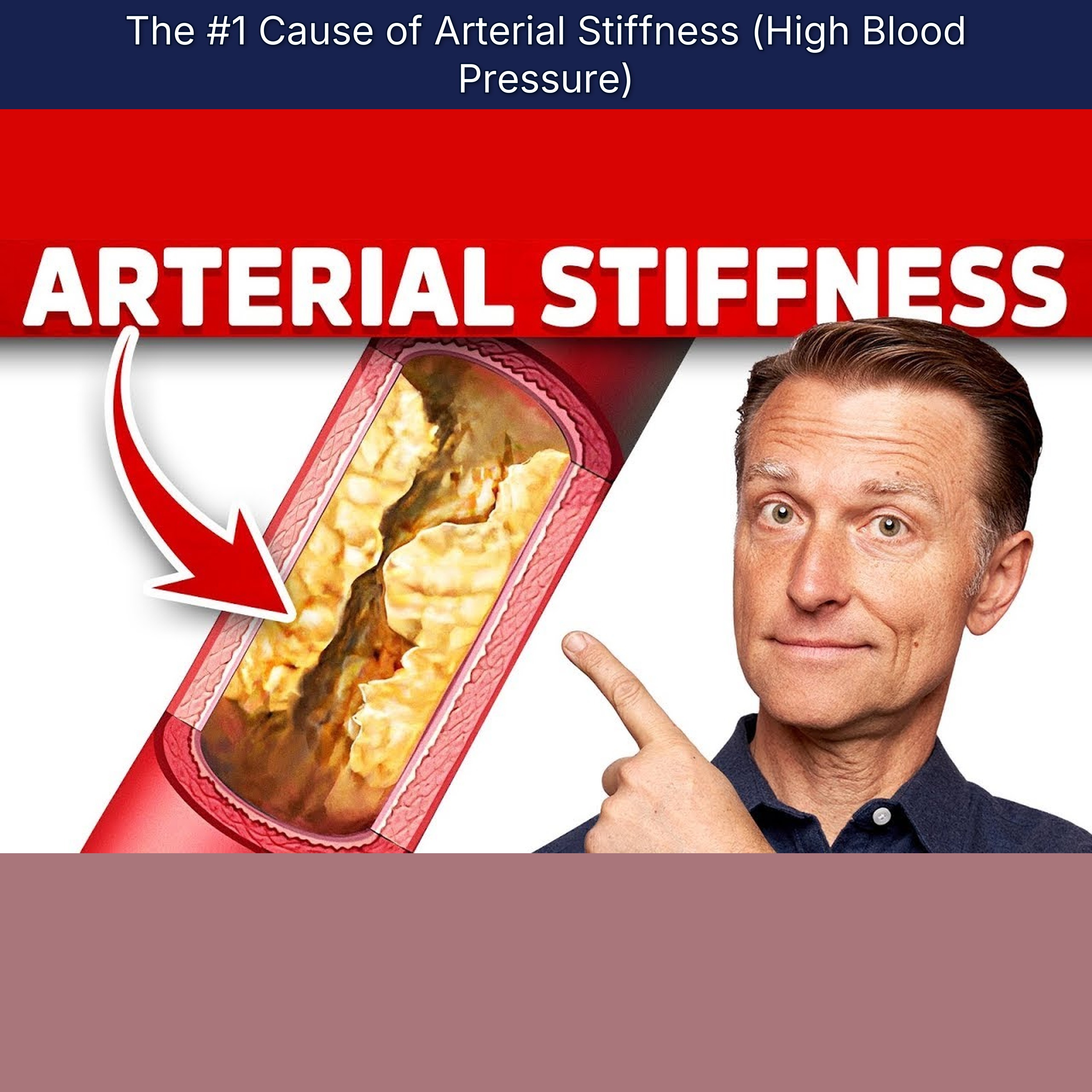 The #1 Cause of Arterial Stiffness (High Blood Pressure)