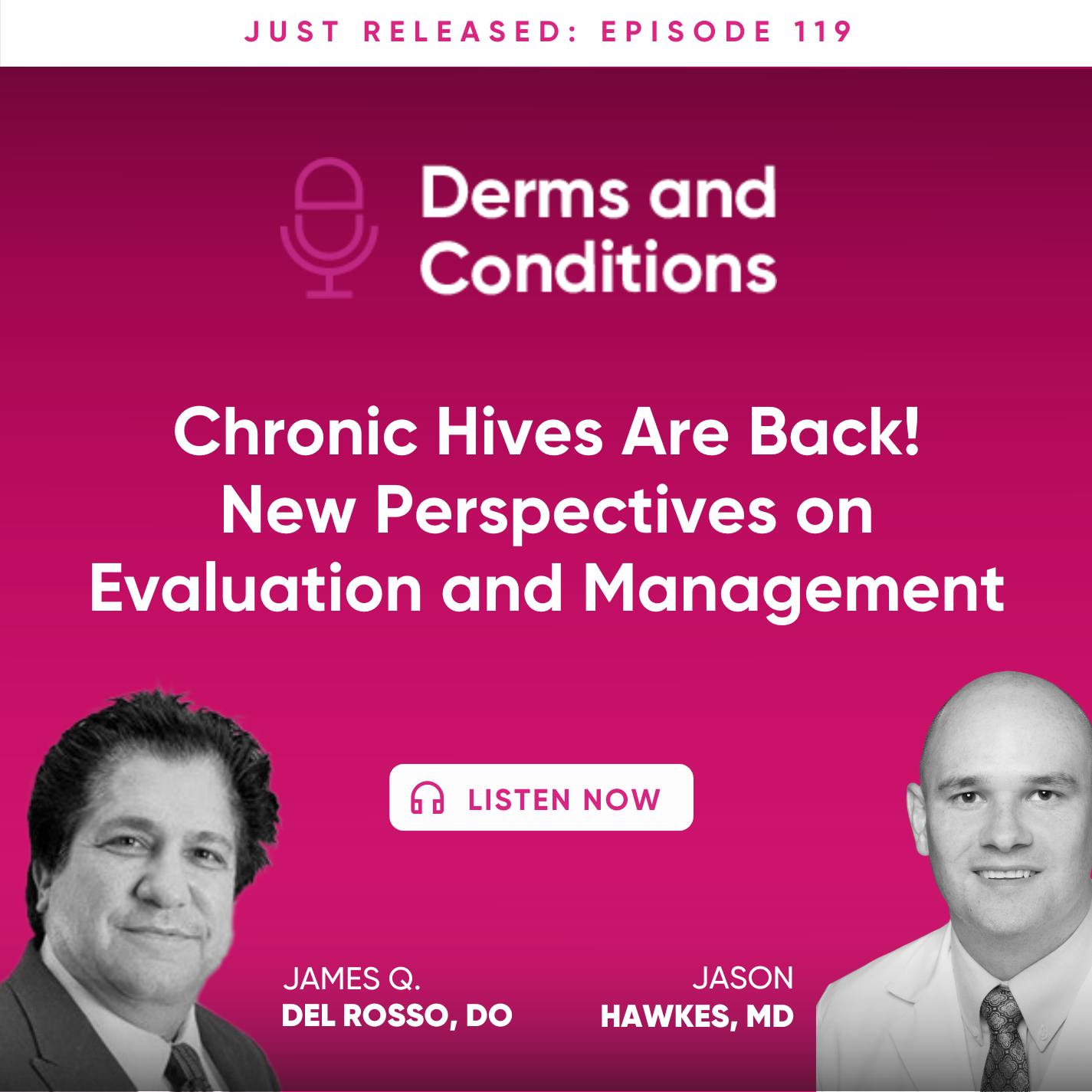 Chronic Hives Are Back! New Perspectives on Evaluation and Management Chronic Hives Are Back! New Perspectives on Evaluation and Management
