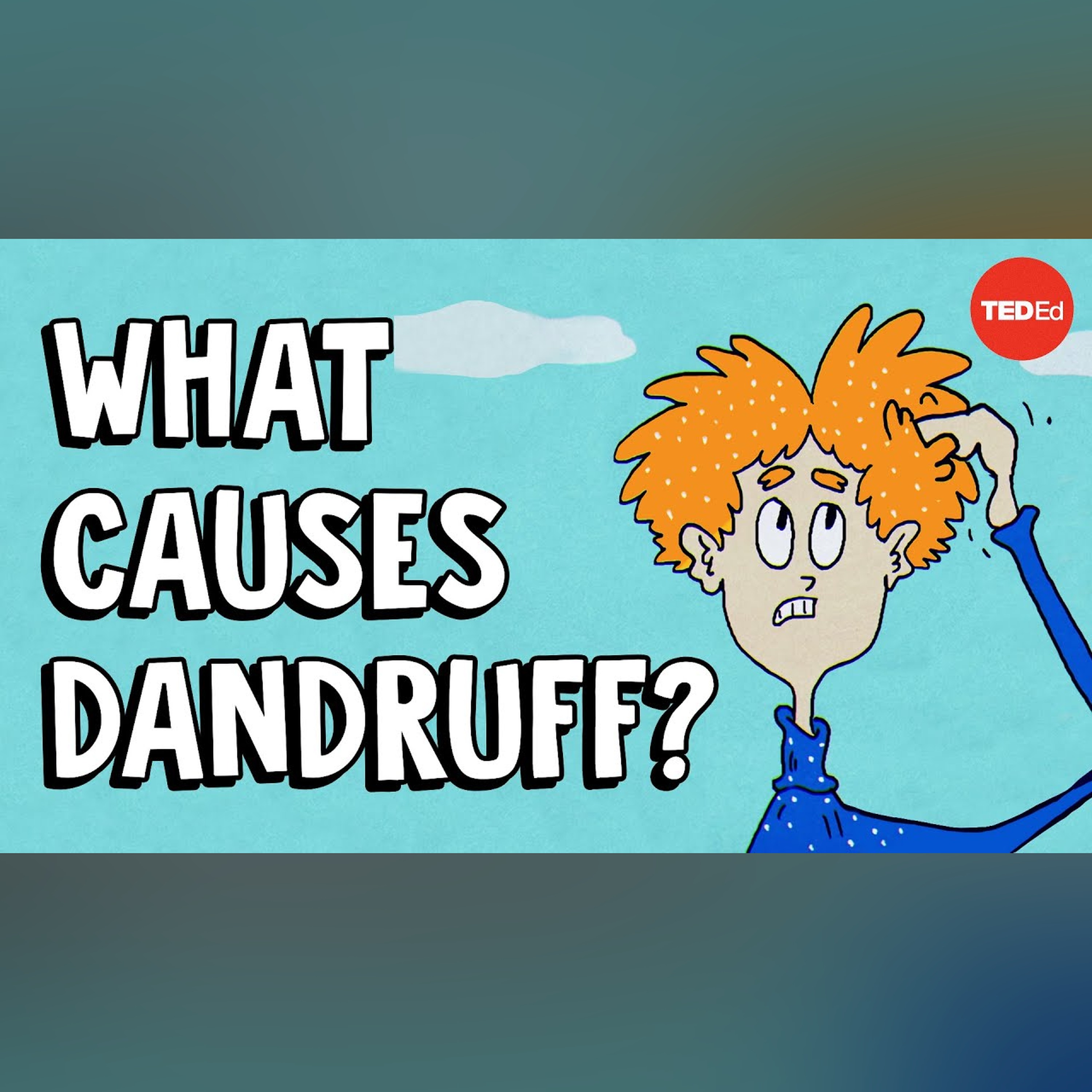 What causes dandruff, and how do you get rid of it? - Thomas L. Dawson episode artwork