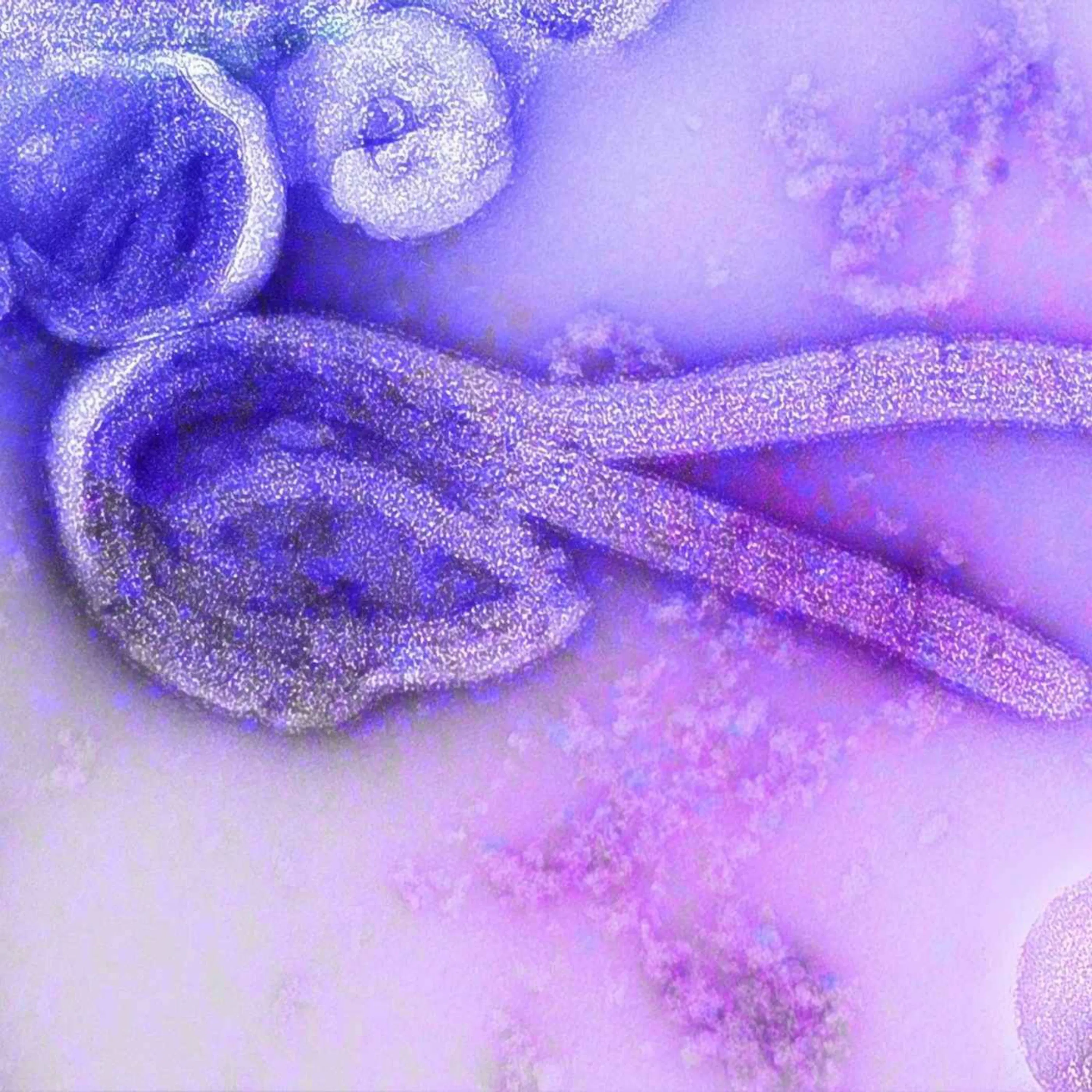 Qu’est-ce que le virus Ebola ?
