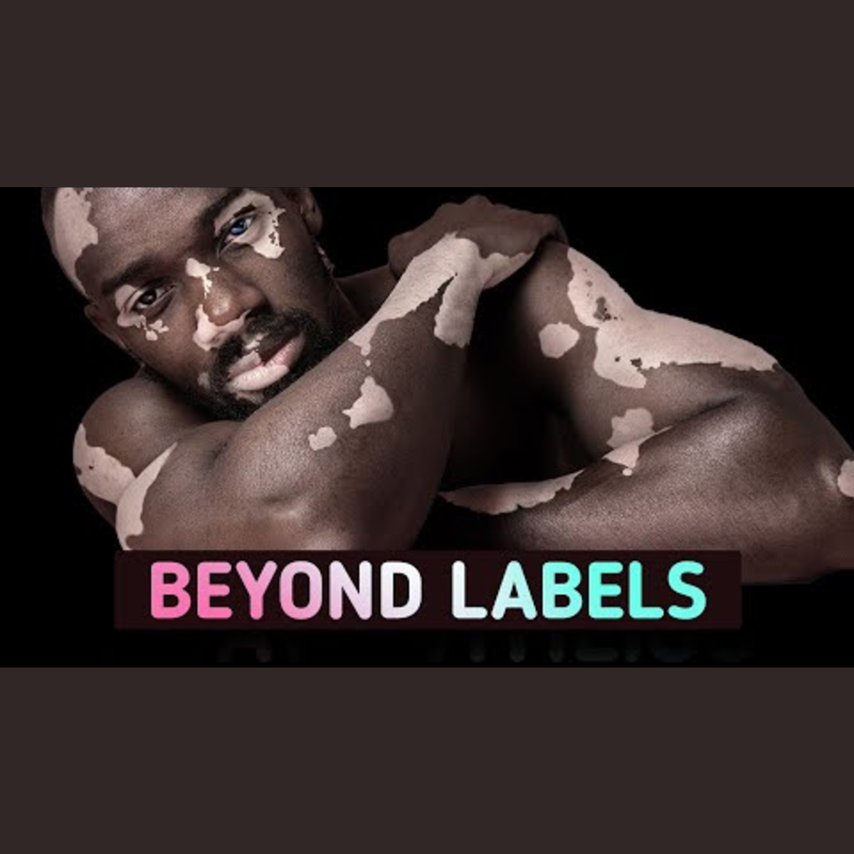 Exploring Fascinating and Rare Human Body Conditions episode artwork