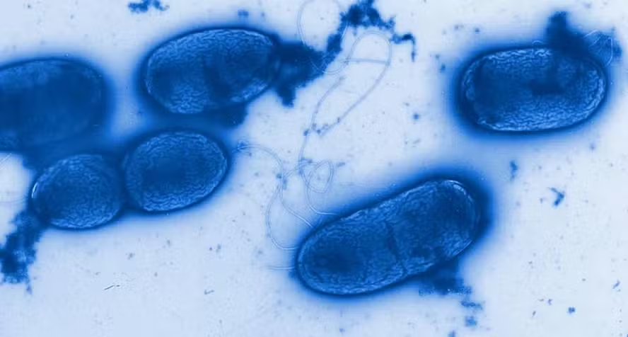 Pseudomonas aeruginosa: entenda por que bactéria preocupa a Anvisa e quais são os riscos à saúde episode artwork