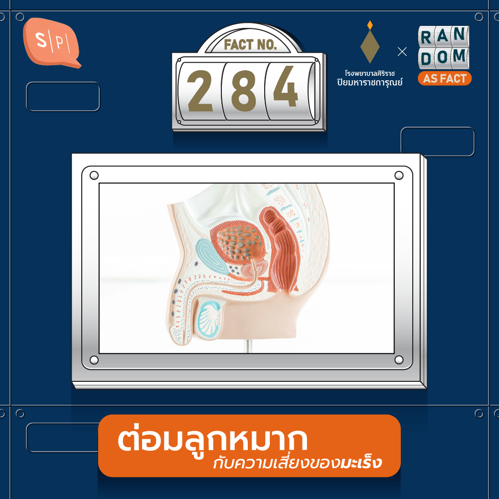 Random as Fact EP284 ต่อมลูกหมากกับความเสี่ยงของมะเร็ง