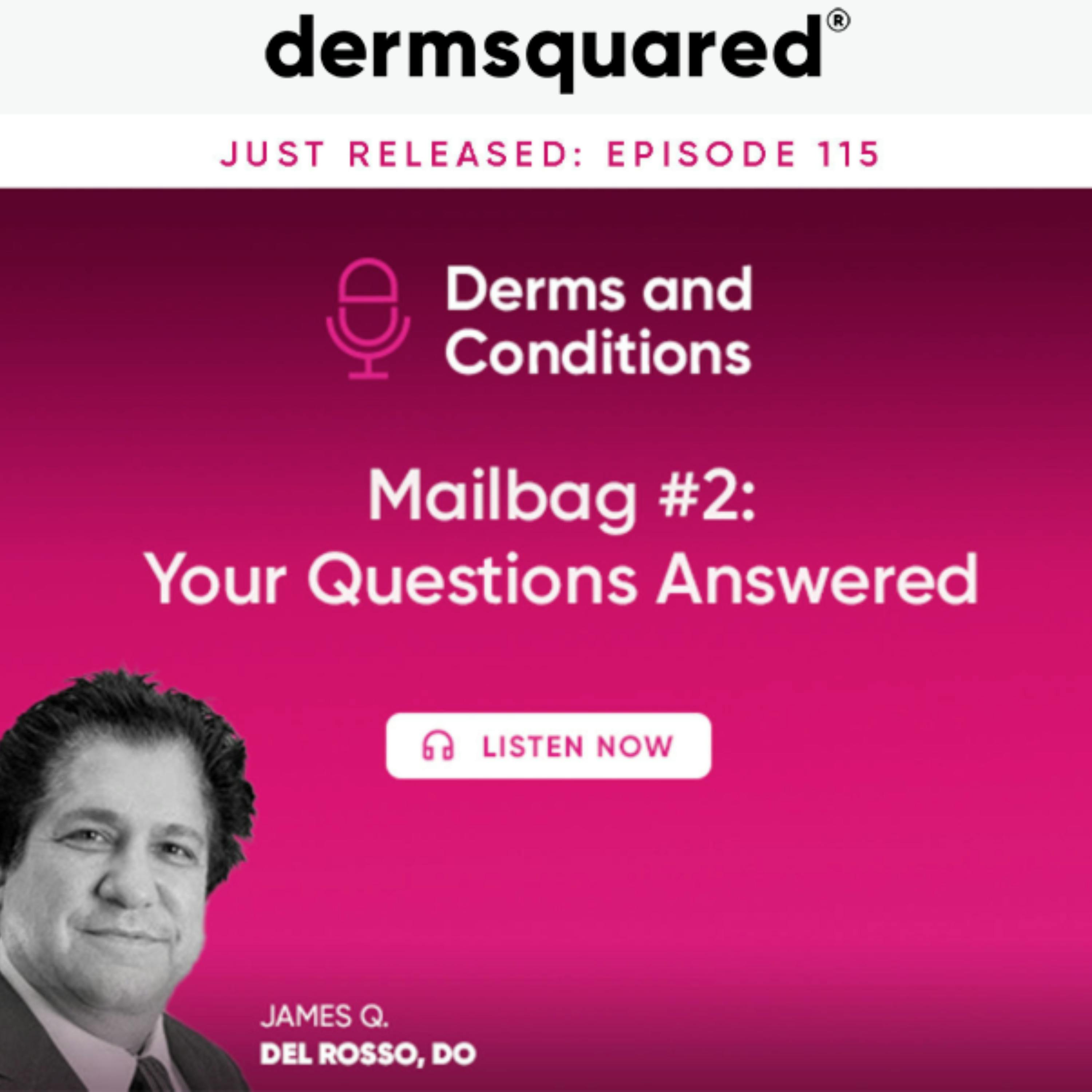 Mailbag 2: Your Questions Answered Mailbag 2: Your Questions Answered