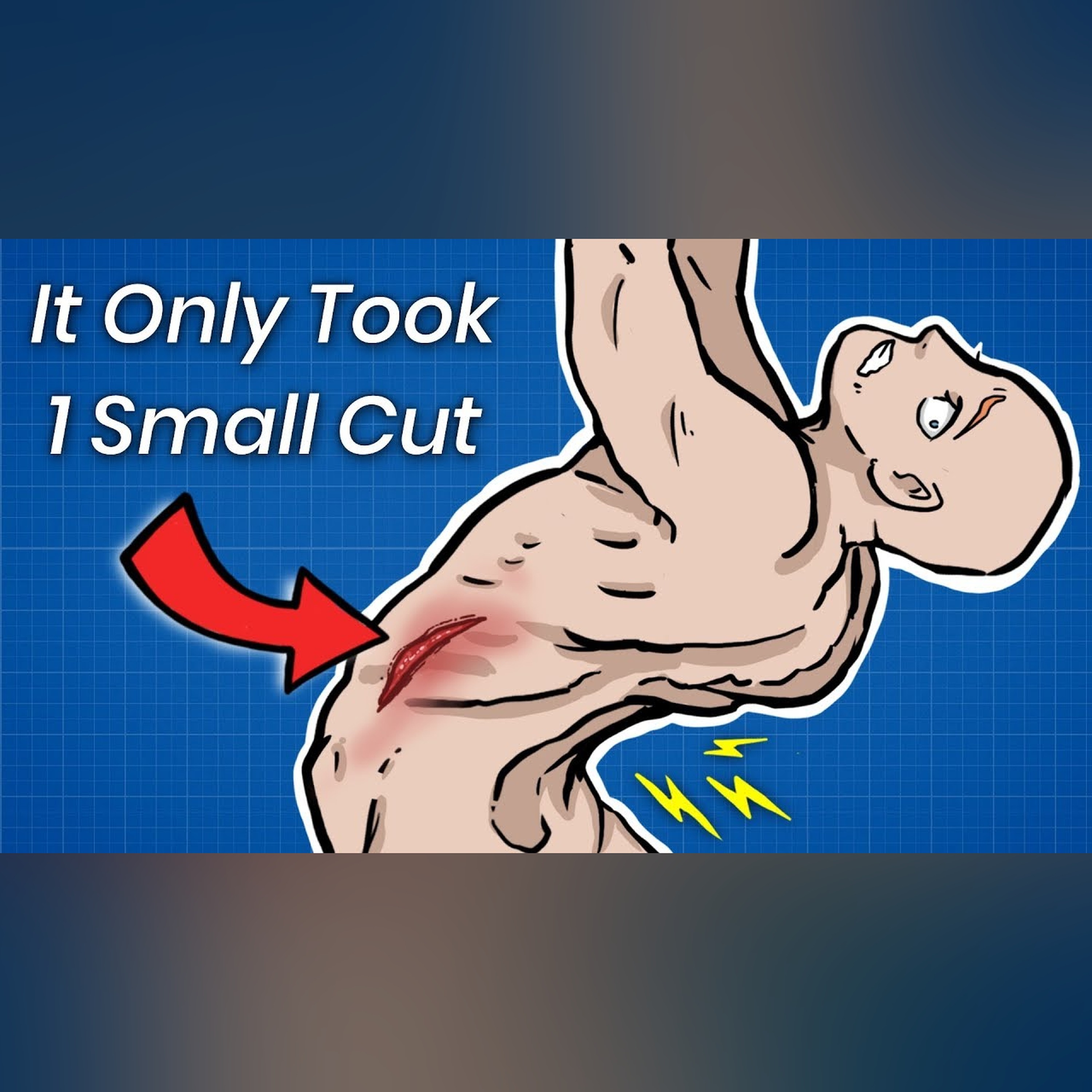How 1 Small Cut Can Break Your Spine
