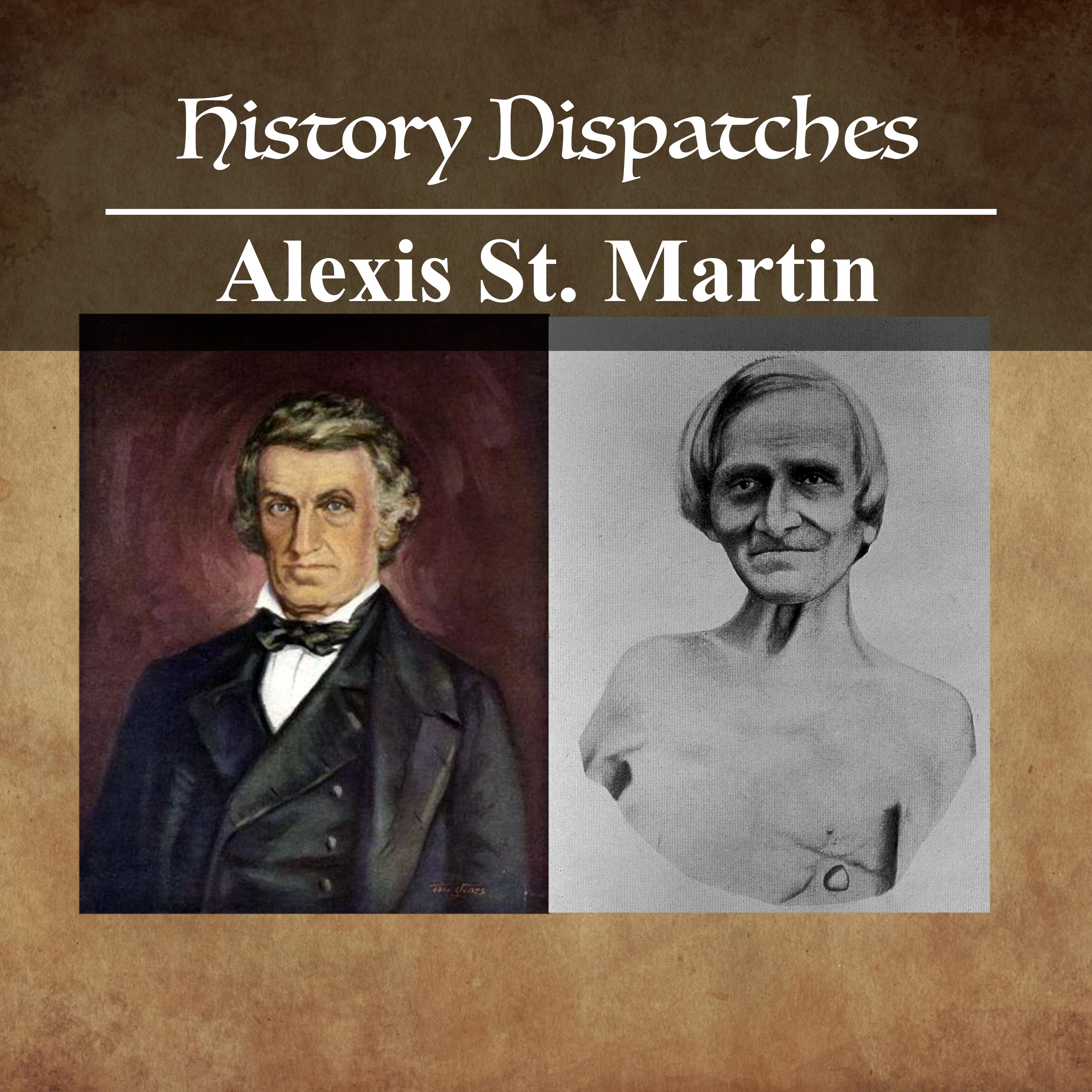 Alexis St. Martin and the gunshot that changed science episode artwork