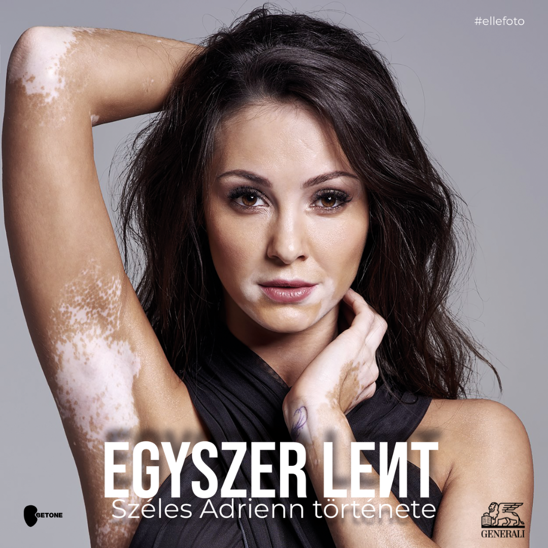 Évekig marcangolta magát, ma már ő segít másoknak - Széles Adrienn története (18)