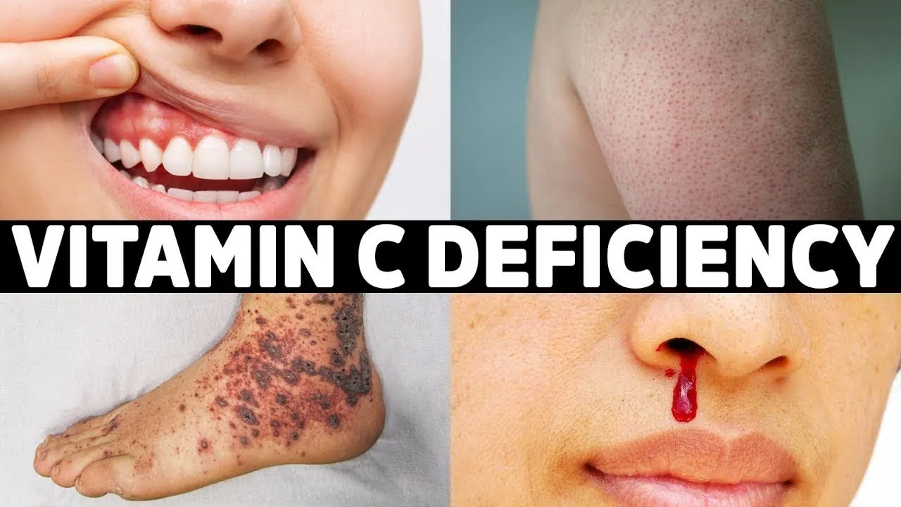 The 7 Signs You're Not Getting Enough Vitamin C episode artwork