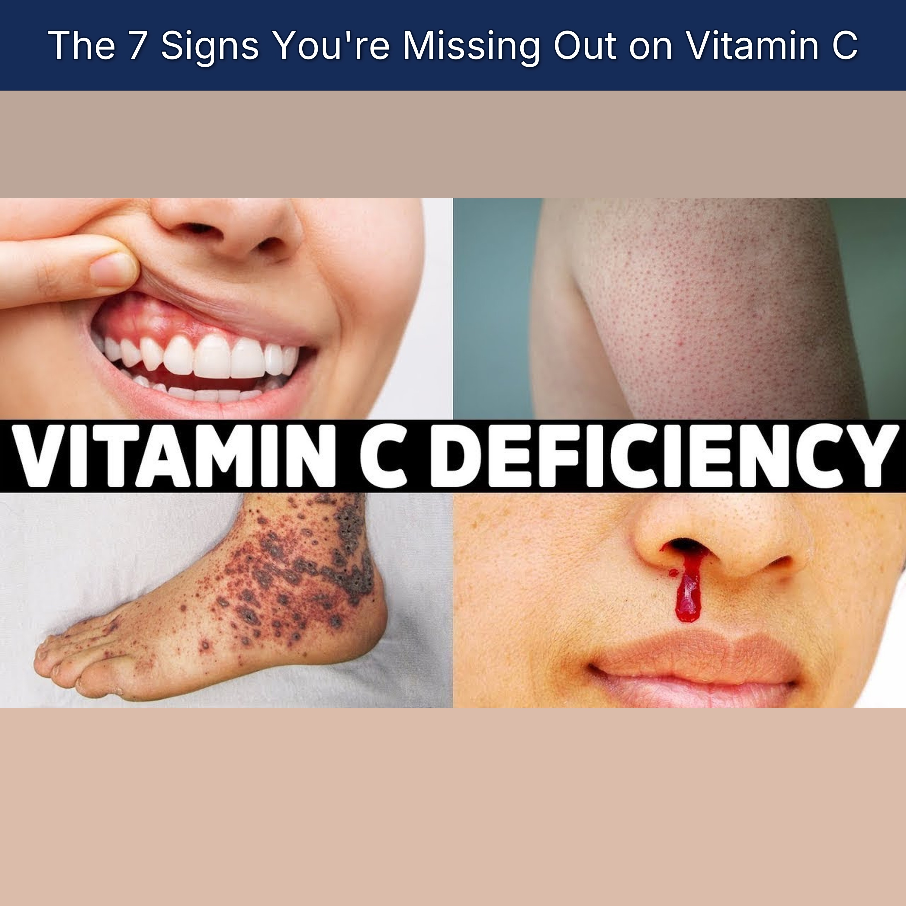The 7 Signs You're Missing Out on Vitamin C episode artwork
