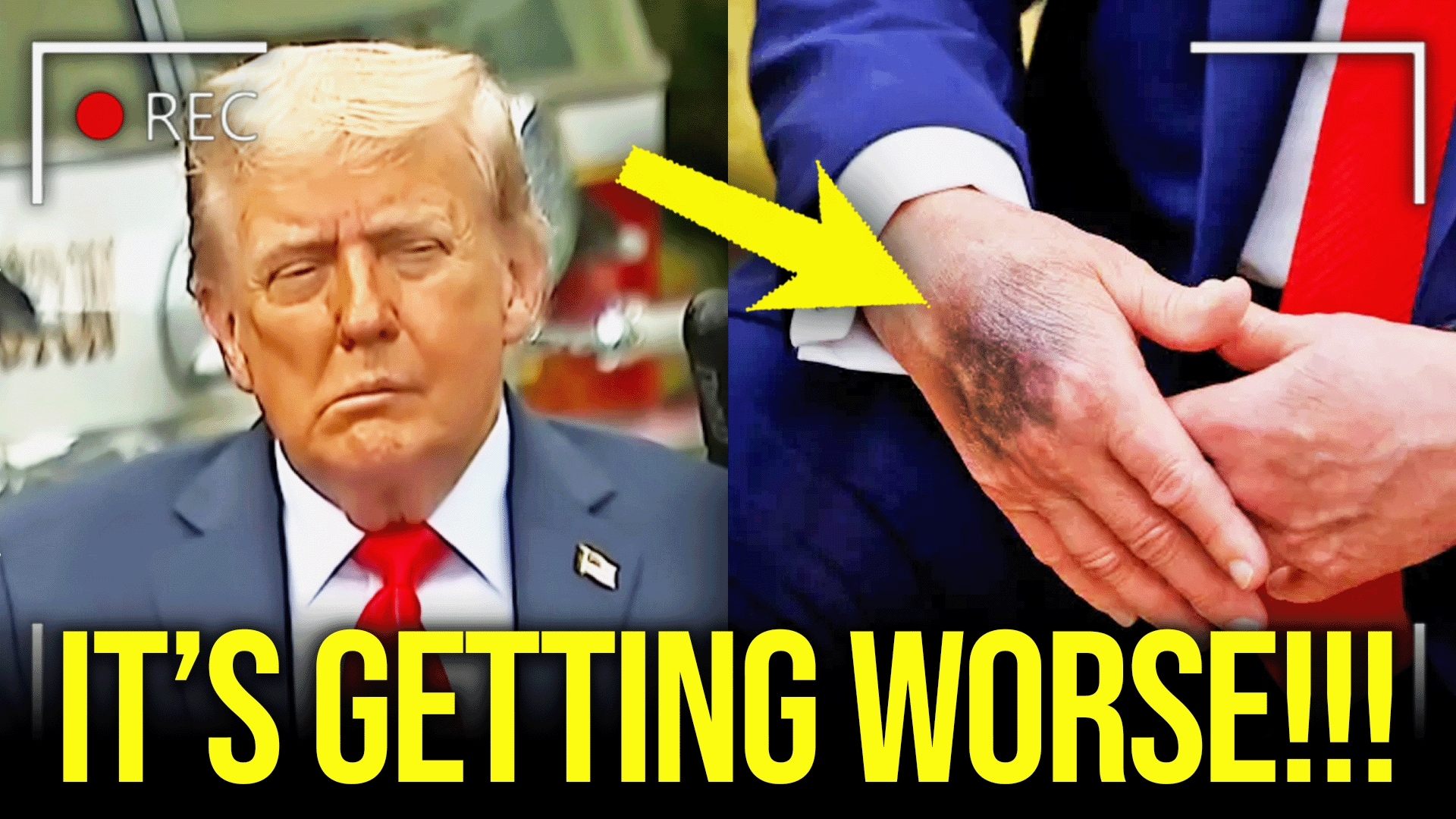 Trump’s SCARY DECLINE Gets EXPOSED On Camera