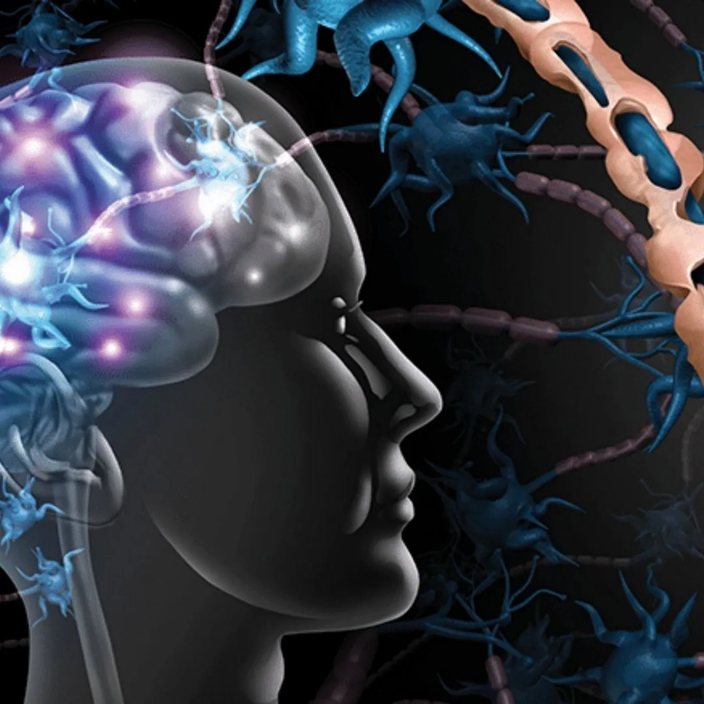 Qu’est-ce que la sclérose en plaques ?