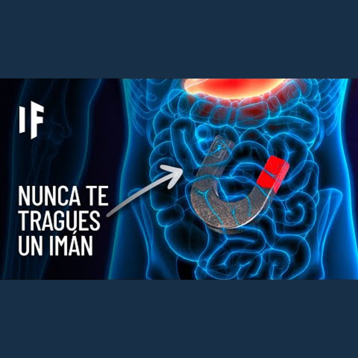 ¿Qué pasaría si te tragaras el imán más poderoso del mundo? episode artwork