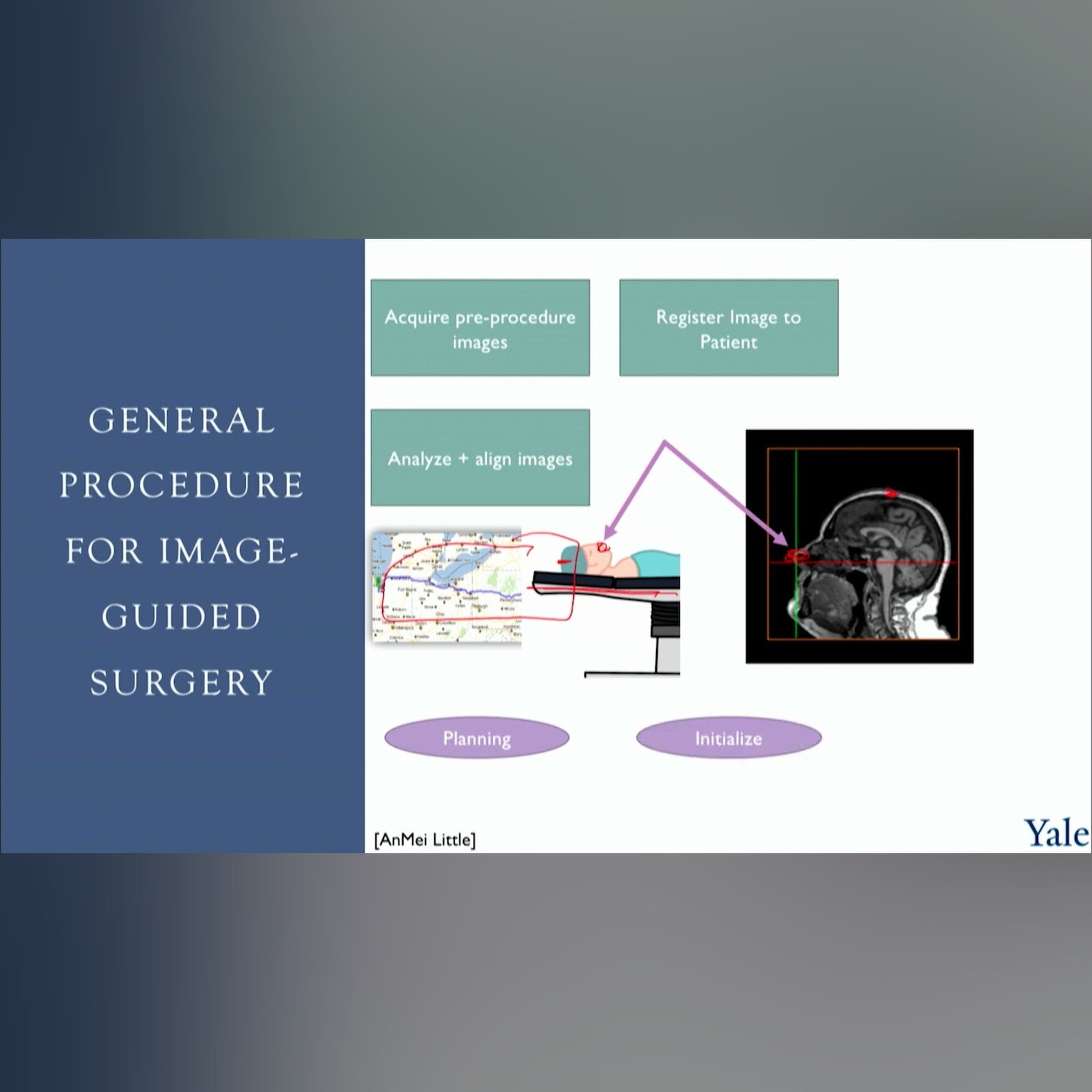 5.3 | GPS for Your Brain? The IGNS Project Explained! Medical Software Course episode artwork