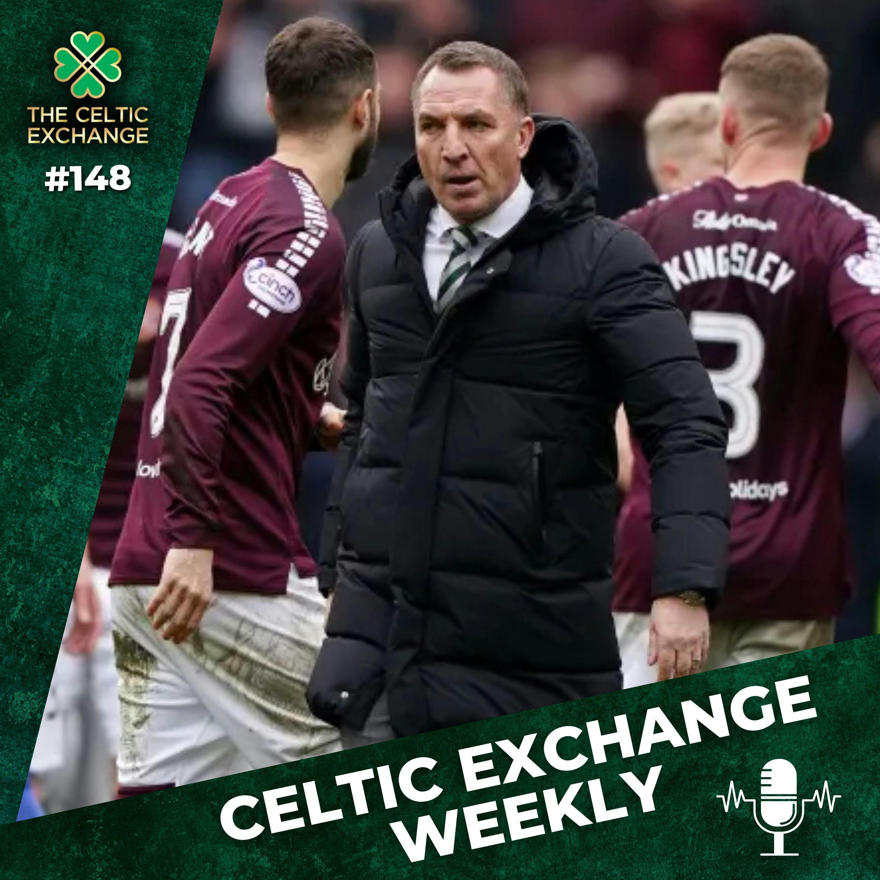Celtic Exchange Weekly: Rodgers Calls It Out, Recruitment Reshuffle Required & The Battle To Save Celtic