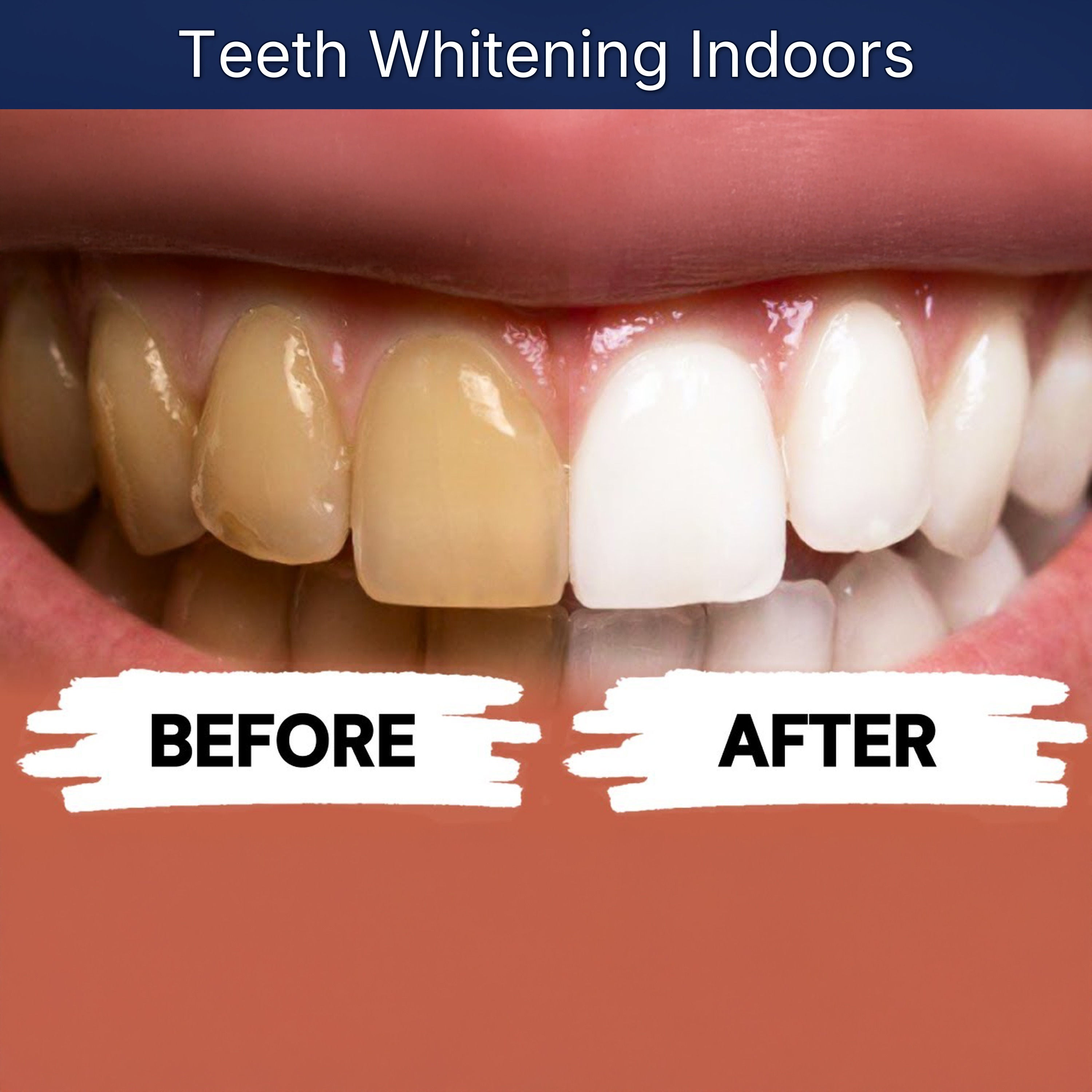 Teeth Whitening Indoors episode artwork