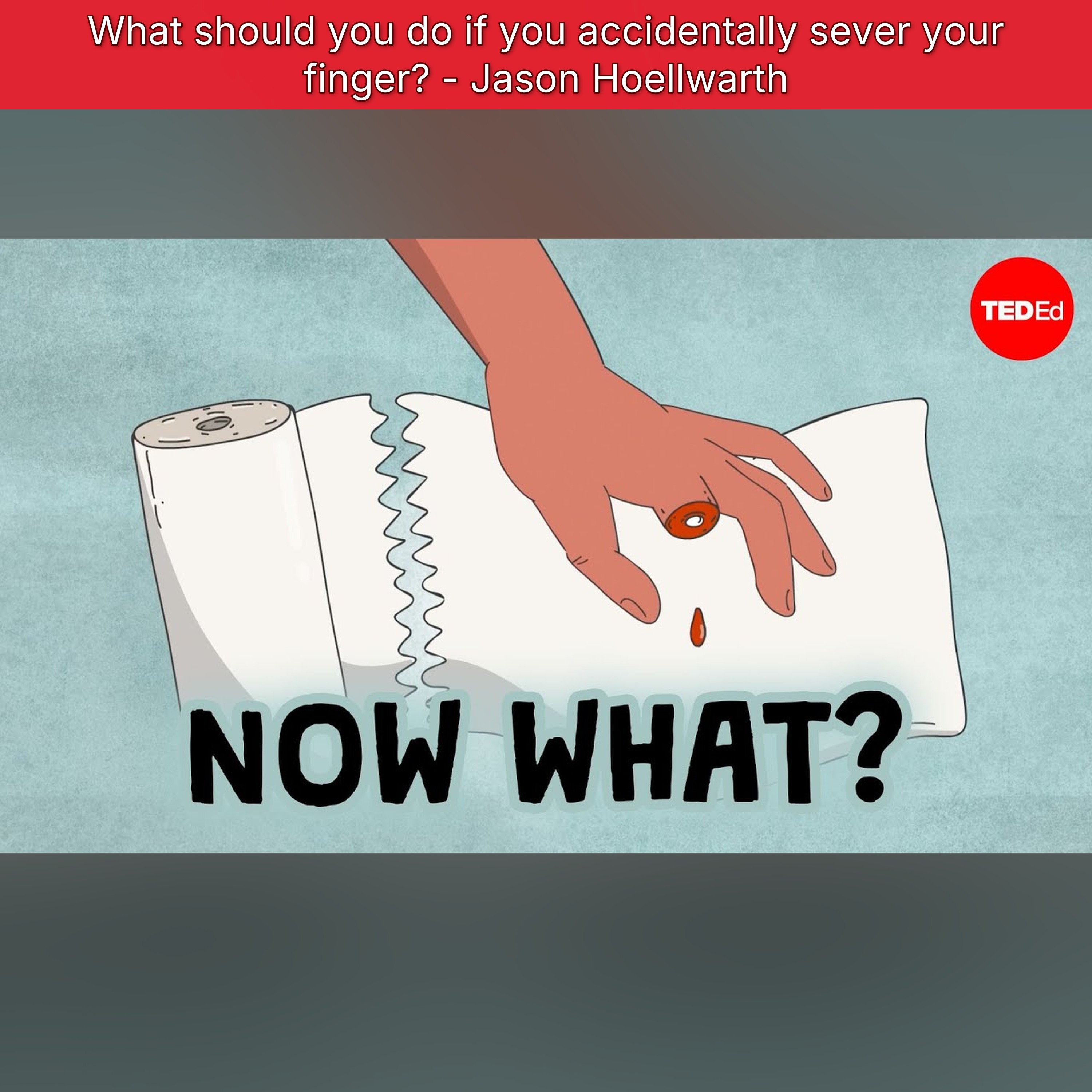 What should you do if you accidentally sever your finger? - Jason Hoellwarth episode artwork