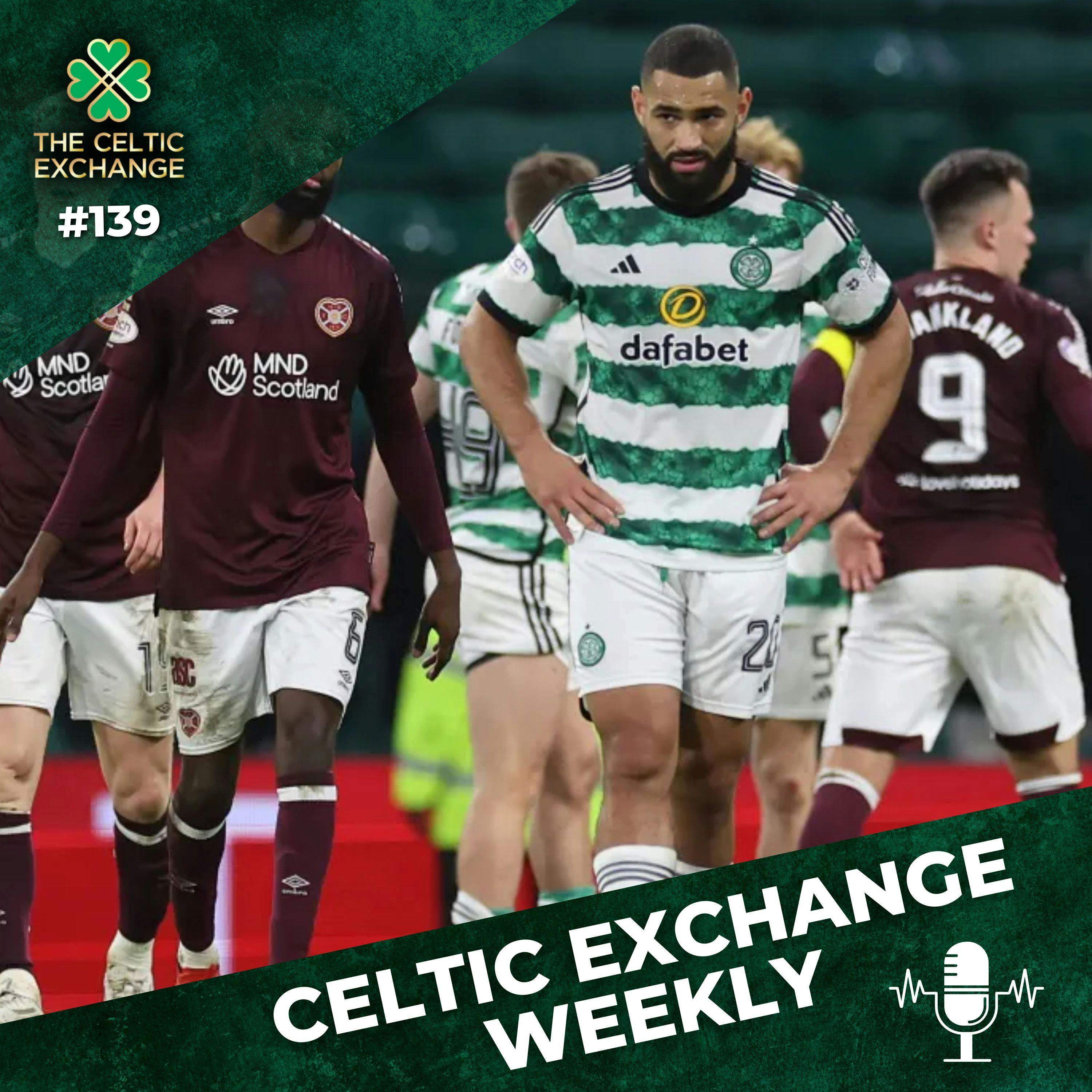 Celtic Exchange Weekly: Calmac’s Concern, More Squad Mysteries and Celtic’s Midfield Lucky Dip