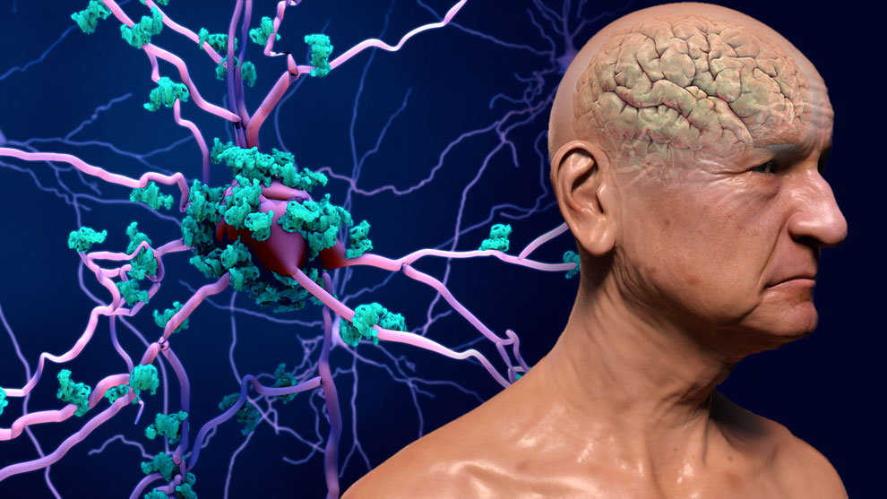 Así se puede revertir el envejecimiento cerebral