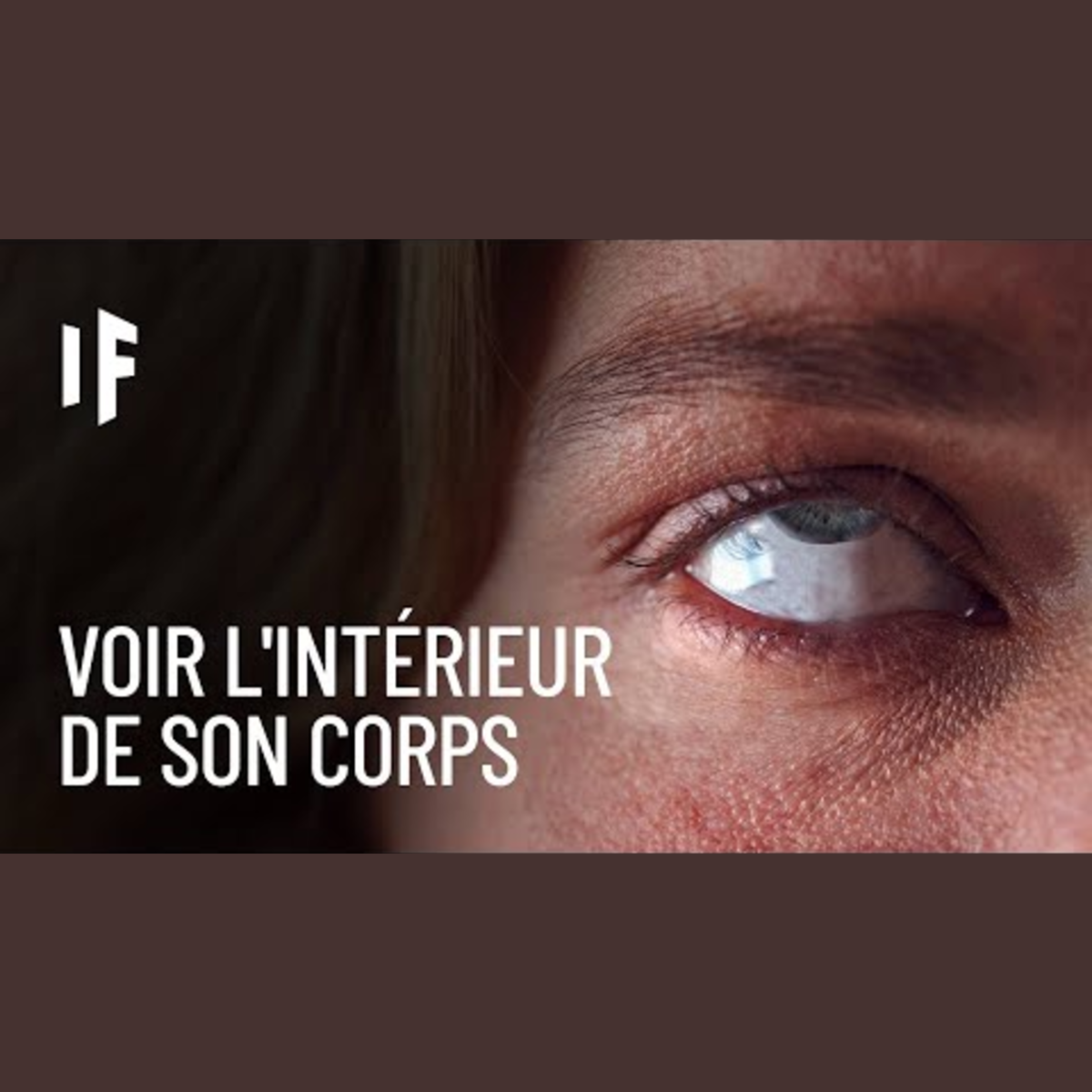 What If Français - Et Si