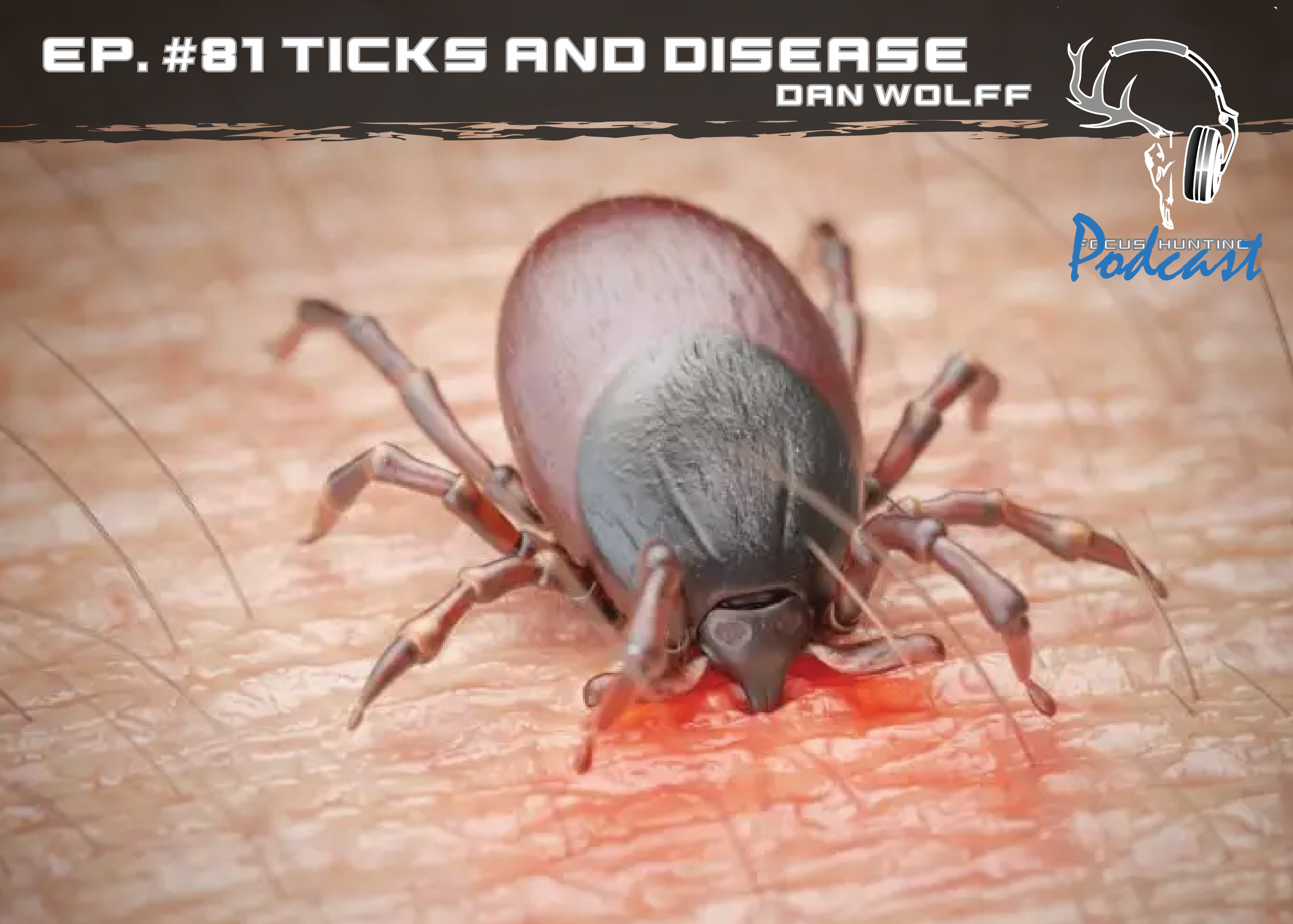 FOCUS HUNTING PODCAST