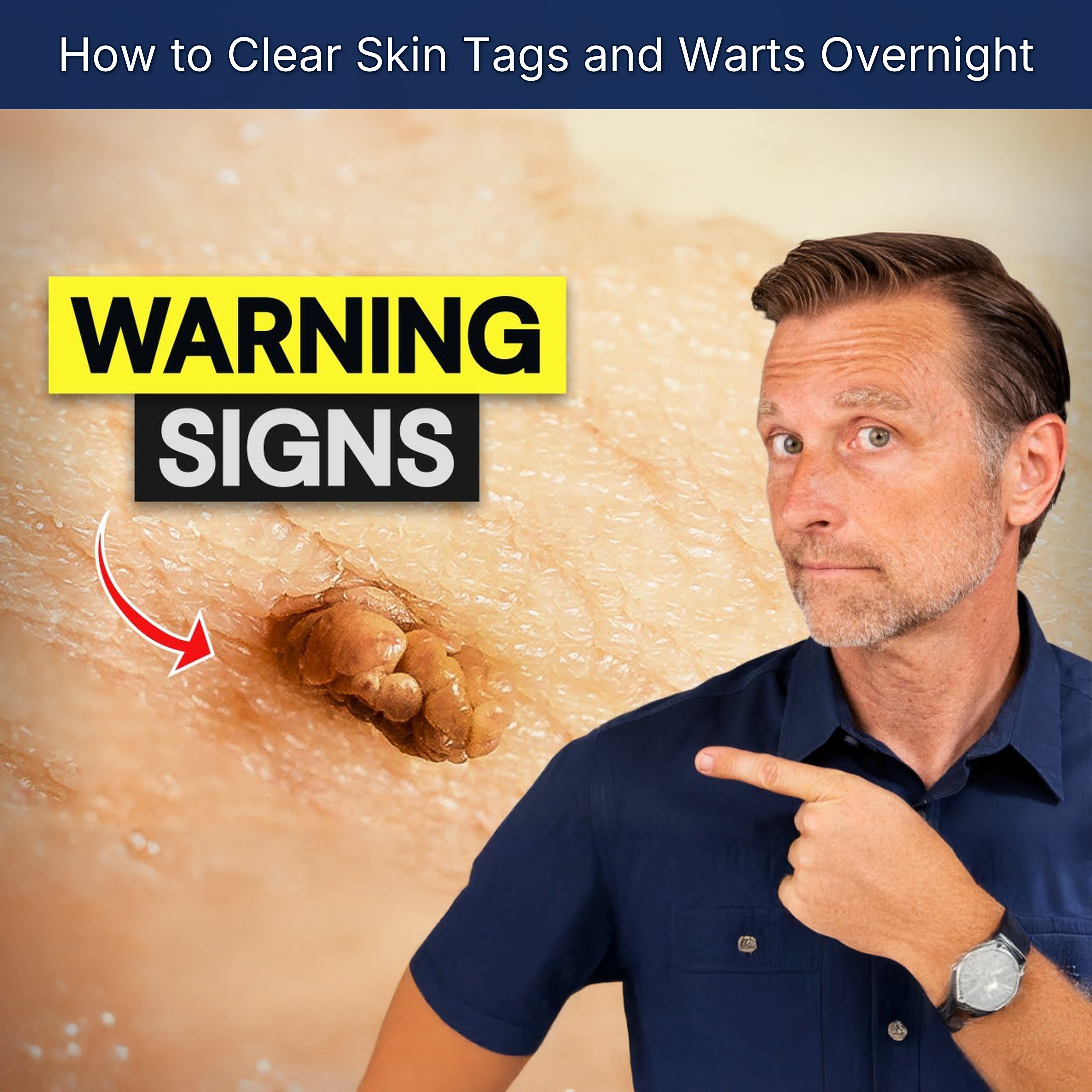 How to Clear Skin Tags and Warts Overnight episode artwork