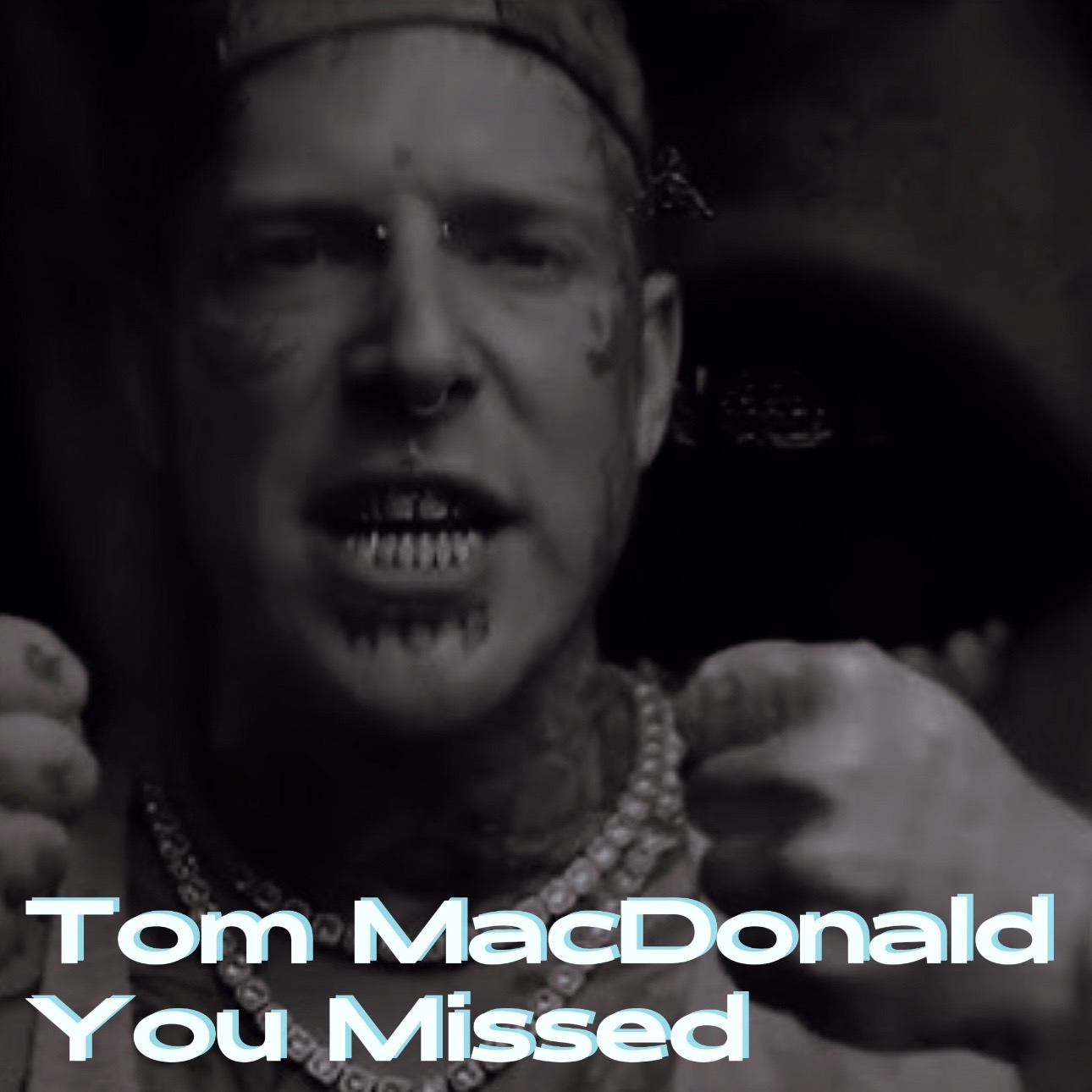Tom MacDonald - You Missed episode artwork